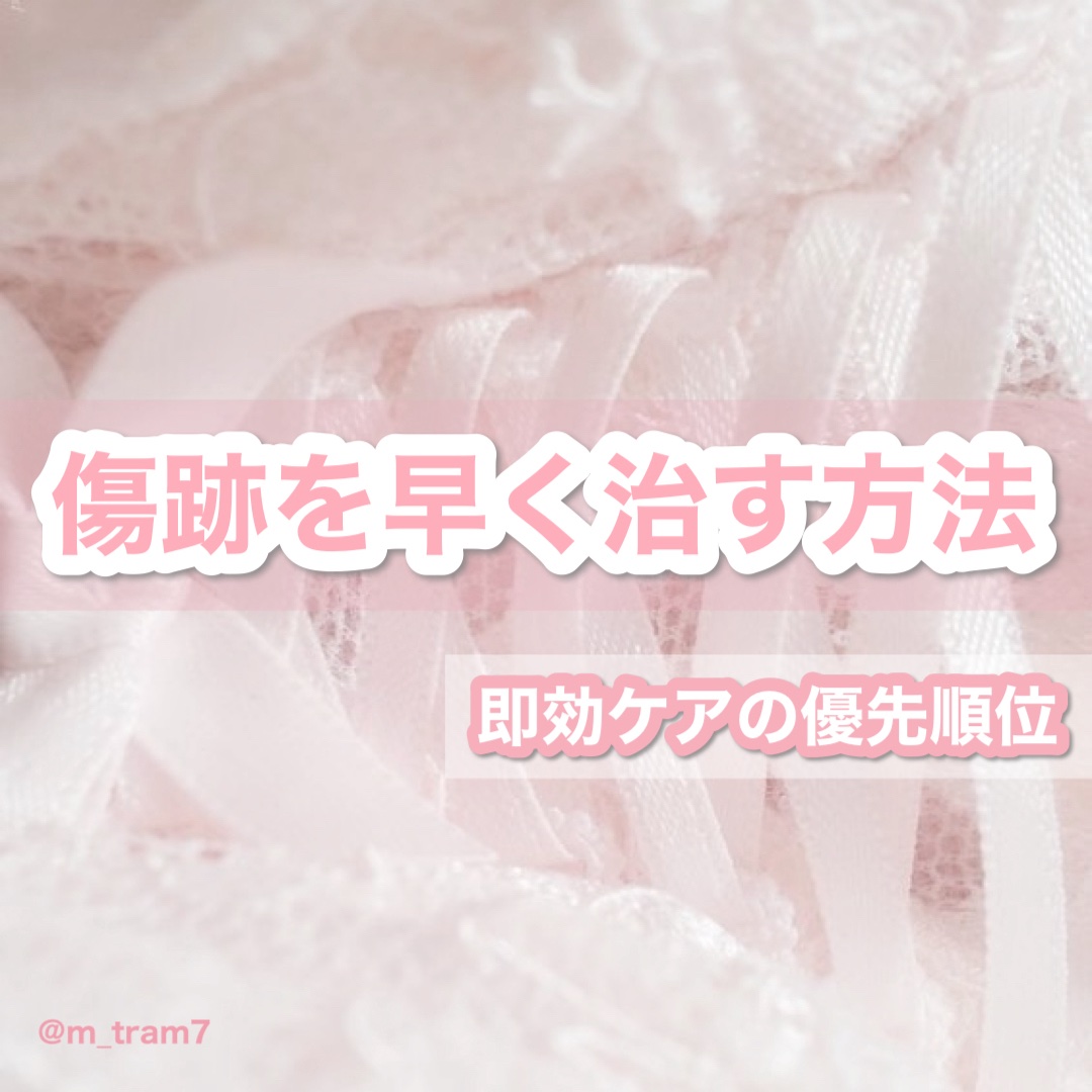 オリジナル ピュアスキンジェリー/ヴァセリン/ボディクリームを使ったクチコミ（1枚目）