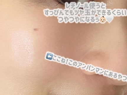 QuSomeレチノA/b.glen/美容液を使ったクチコミ(3枚目)