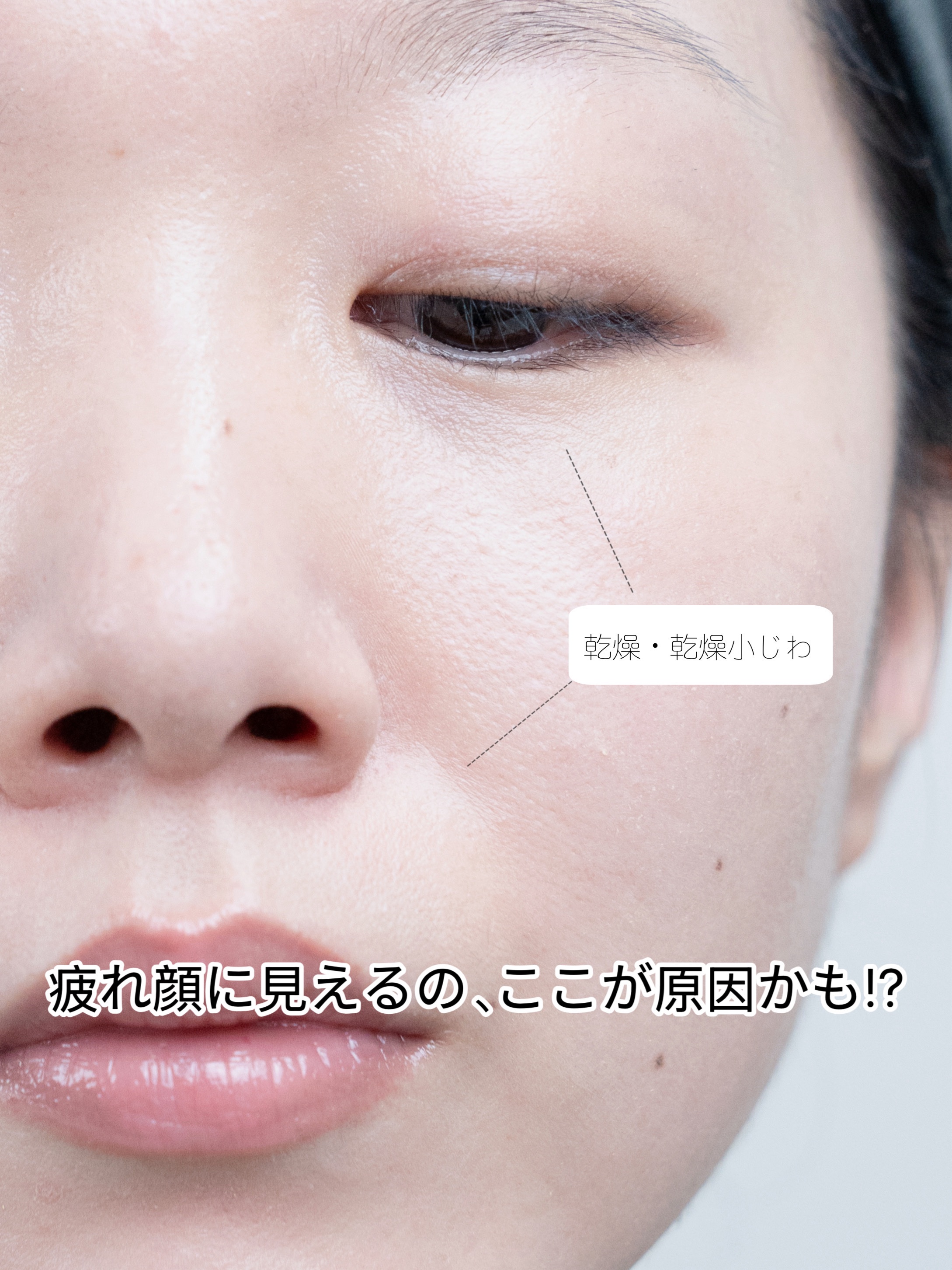 ごめんね素肌　スポットケアマスク/クリアターン/シートマスク・パックを使ったクチコミ（2枚目）