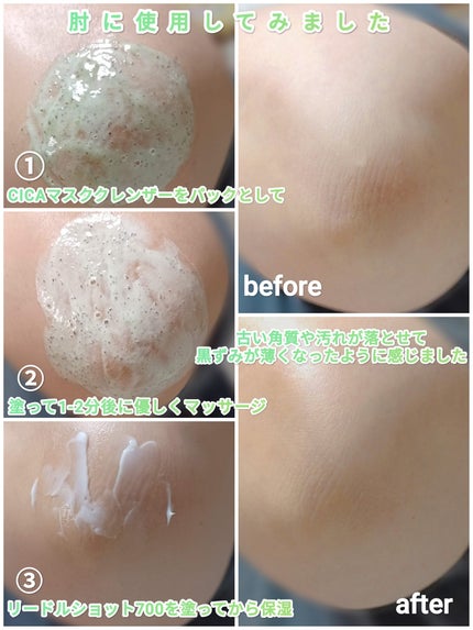 リードルショット700/VT/美容液を使ったクチコミ(4枚目)