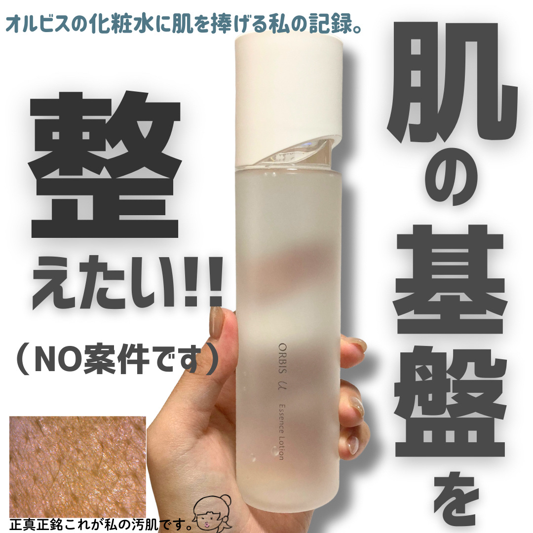 オルビスユー エッセンスローション /オルビス/化粧水を使ったクチコミ（1枚目）