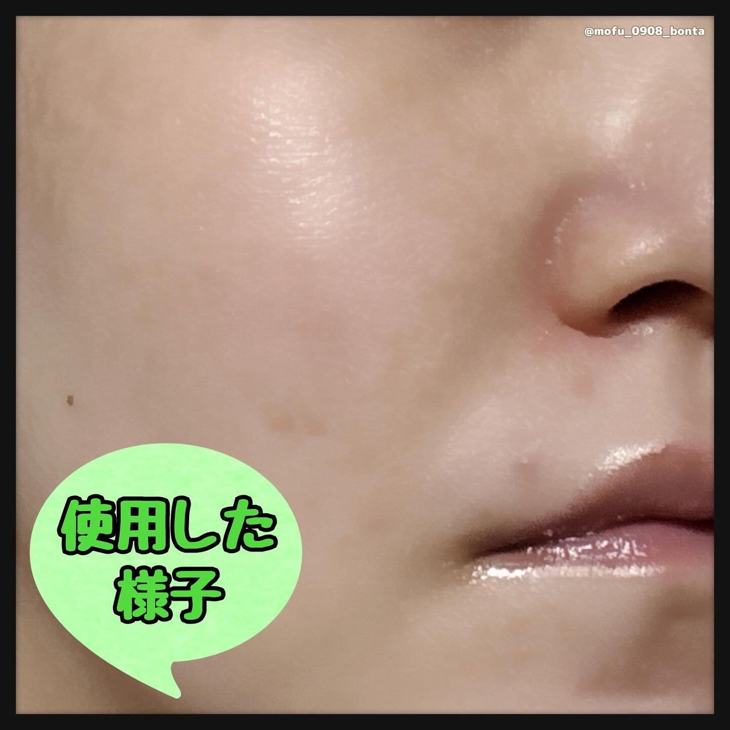 トラブルパッチマスク/EIOM/その他スキンケアを使ったクチコミ(7枚目)