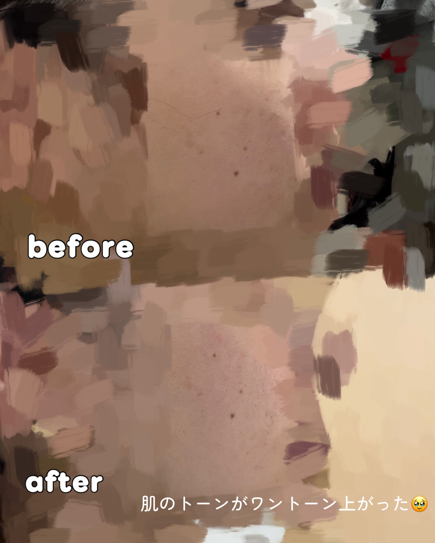 エファクラ ピールケア セラム/ラ ロッシュ ポゼ/美容液を使ったクチコミ(2枚目)