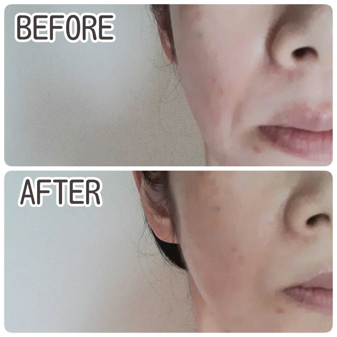 KC SKIN モイストエイジケアセラム/KC SKIN – Kristen Claire/美容液を使ったクチコミ(6枚目)