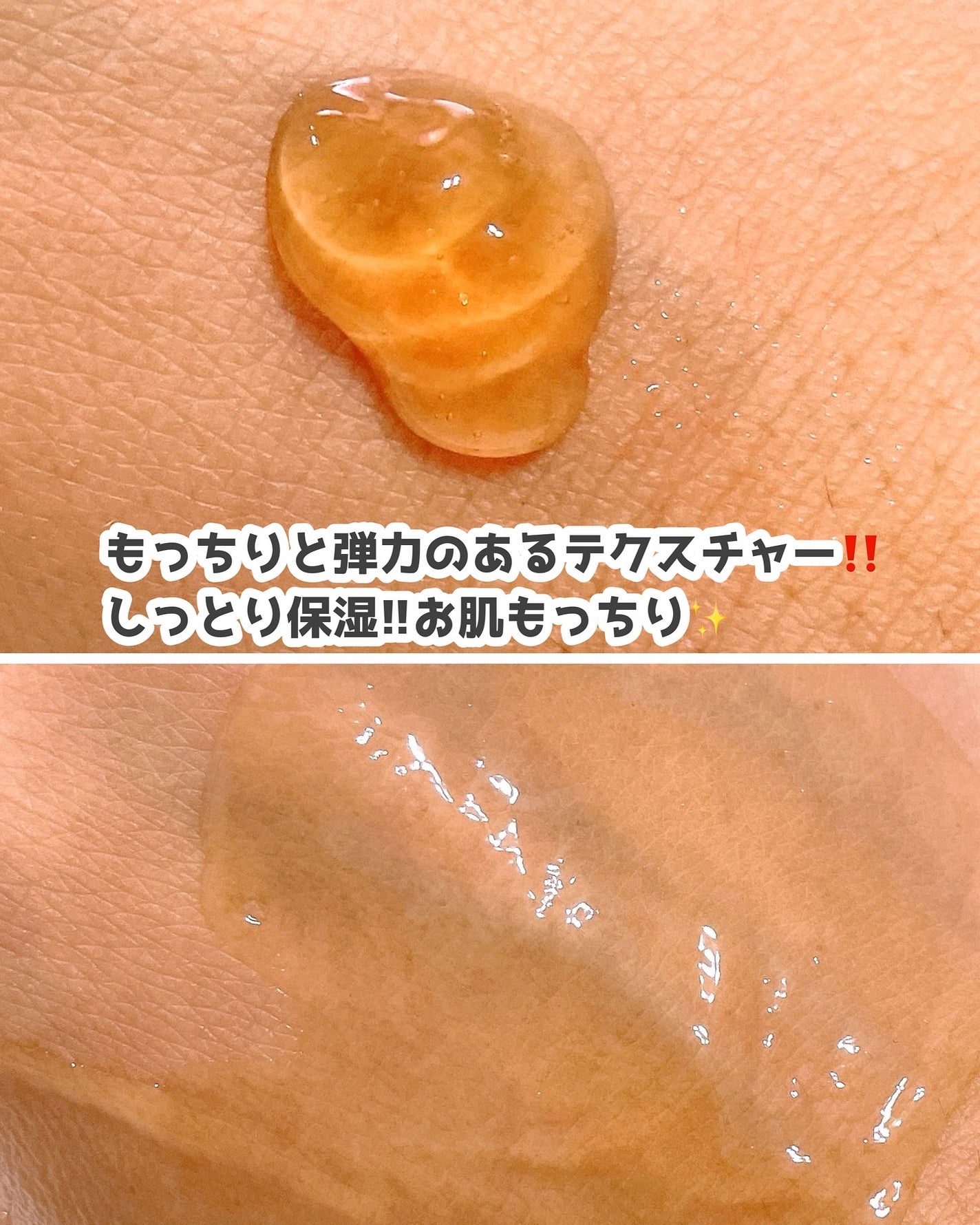 360度ショットPDRNアクティブセラム/センテリアン24/美容液を使ったクチコミ(5枚目)