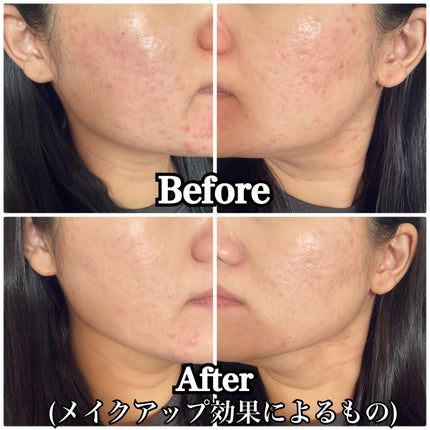 アイシーフィットカバークッションEX/TFIT/クッションファンデーションを使ったクチコミ(5枚目)