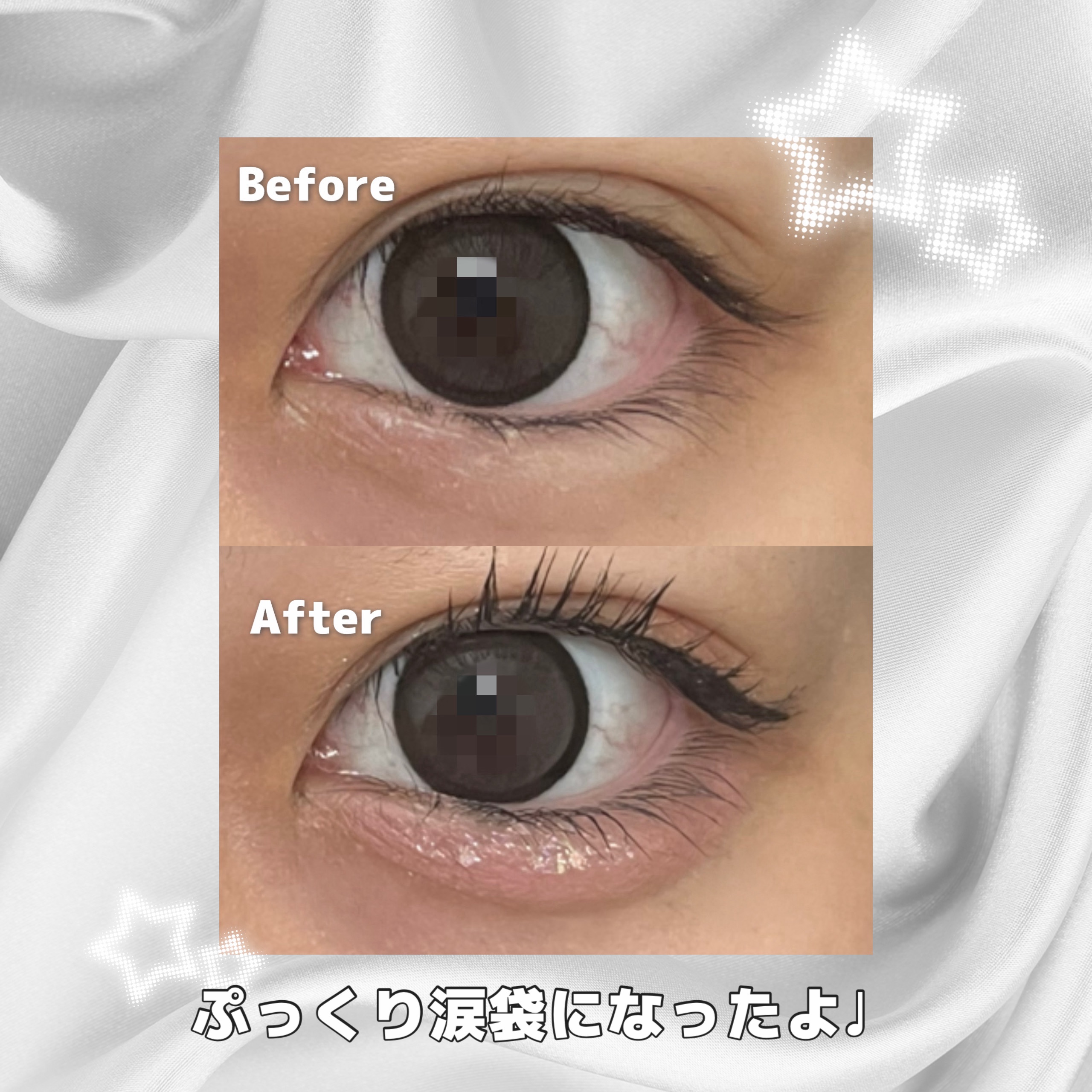 アイバッグコンシーラー/キャンメイク/ペンシルコンシーラーを使ったクチコミ（3枚目）