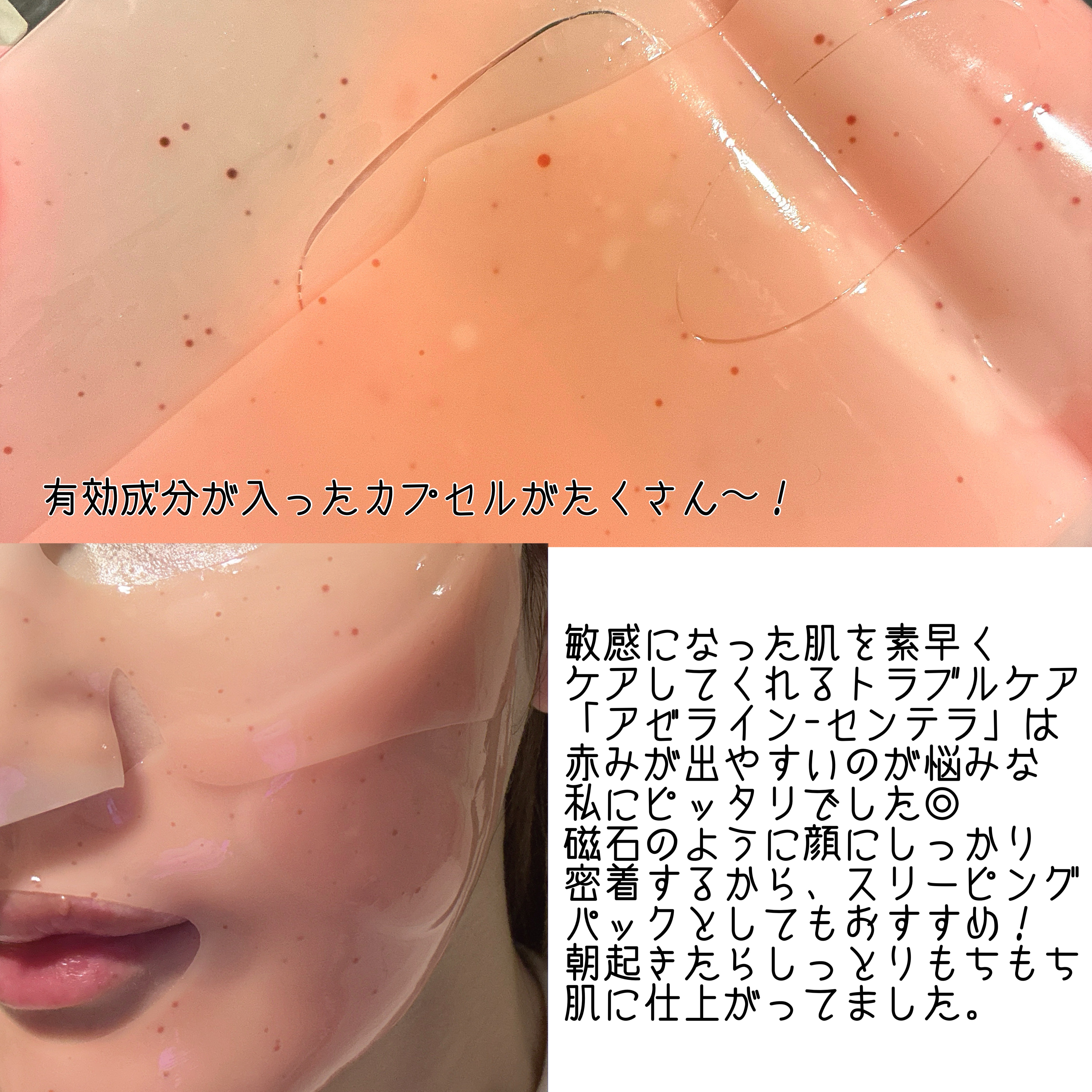 アゼライン-センテラ スキンマグネットマスク/Dr.nineteen/シートマスク・パックを使ったクチコミ（3枚目）