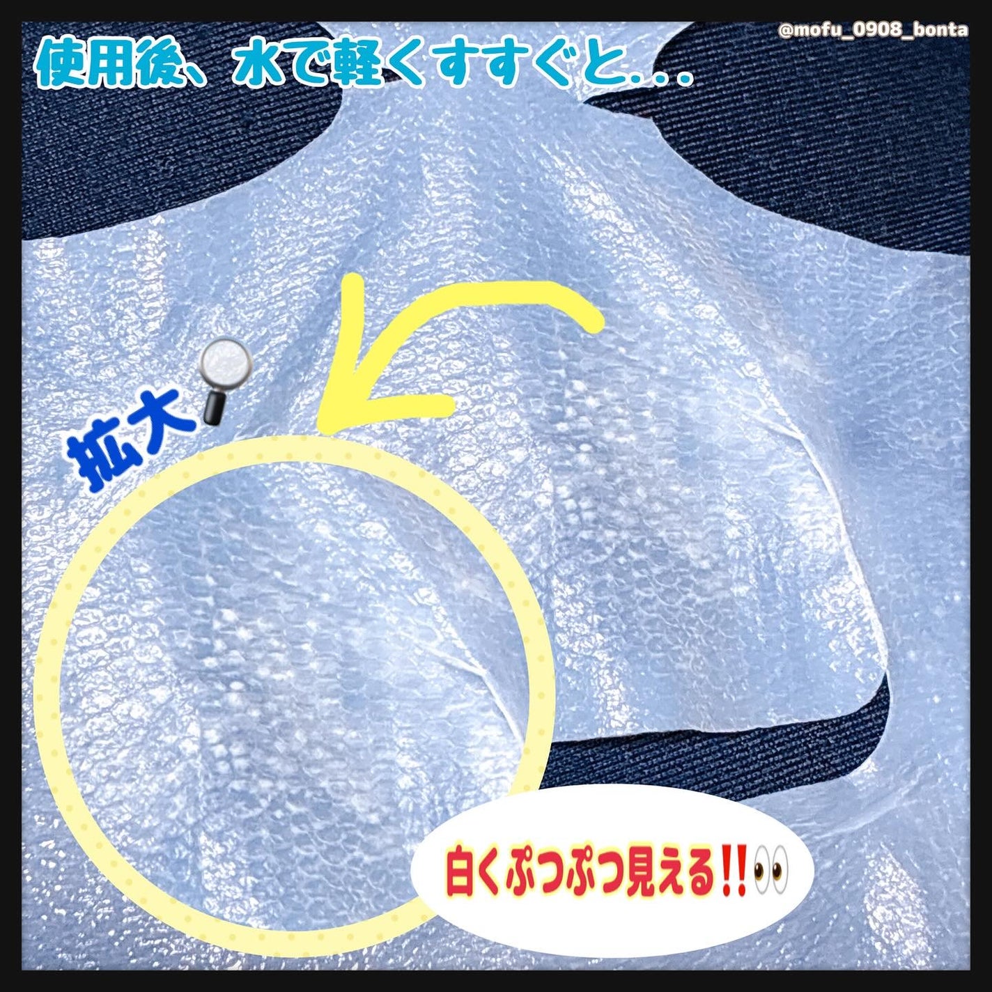 トラブルパッチマスク/EIOM/その他スキンケアを使ったクチコミ(6枚目)