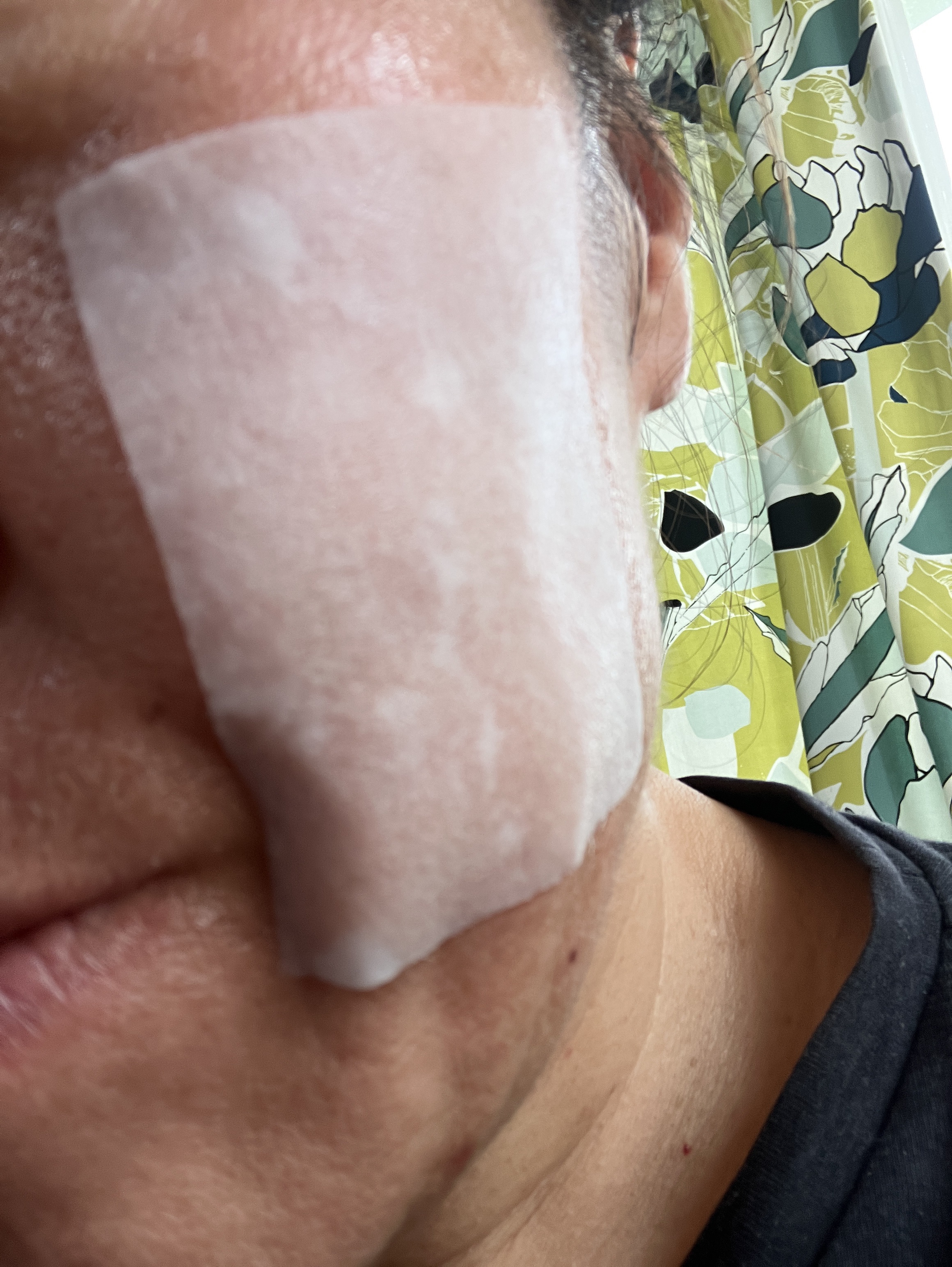 リズム ピコレーザー ニードルスポットパック/RISM/シートマスク・パックを使ったクチコミ（2枚目）