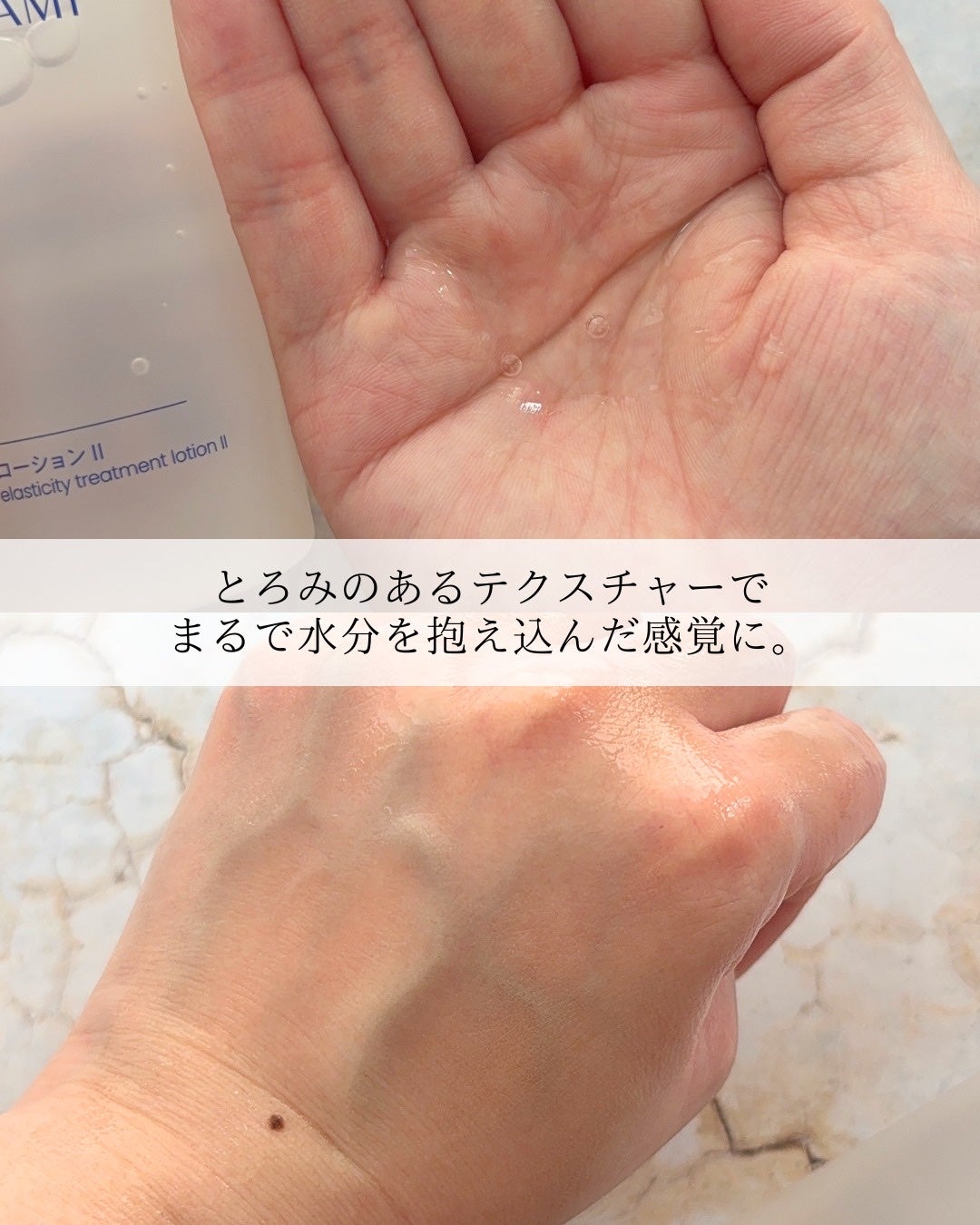 タカミローション Ⅰ/タカミ/化粧水を使ったクチコミ(6枚目)