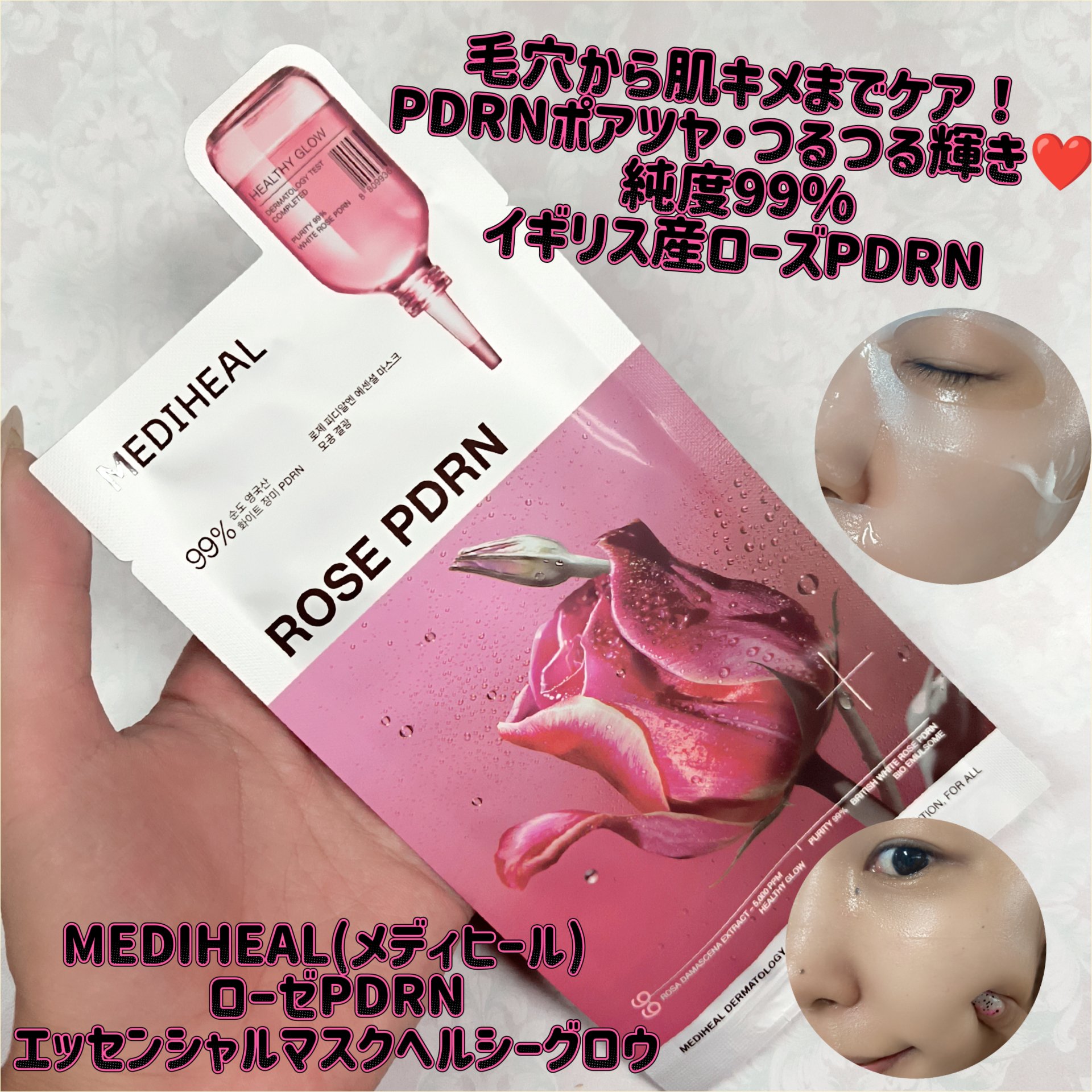ローゼPDRNエッセンシャルマスクヘルシーグロウ/MEDIHEAL/シートマスク・パックを使ったクチコミ（1枚目）