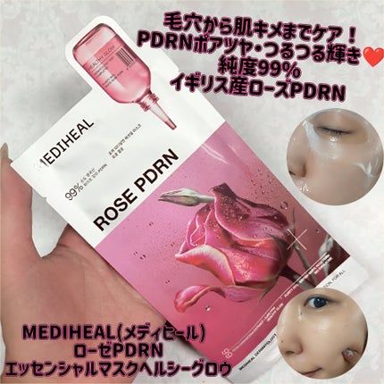 ローゼPDRNエッセンシャルマスクヘルシーグロウ/MEDIHEAL/シートマスク・パックを使ったクチコミ(1枚目)