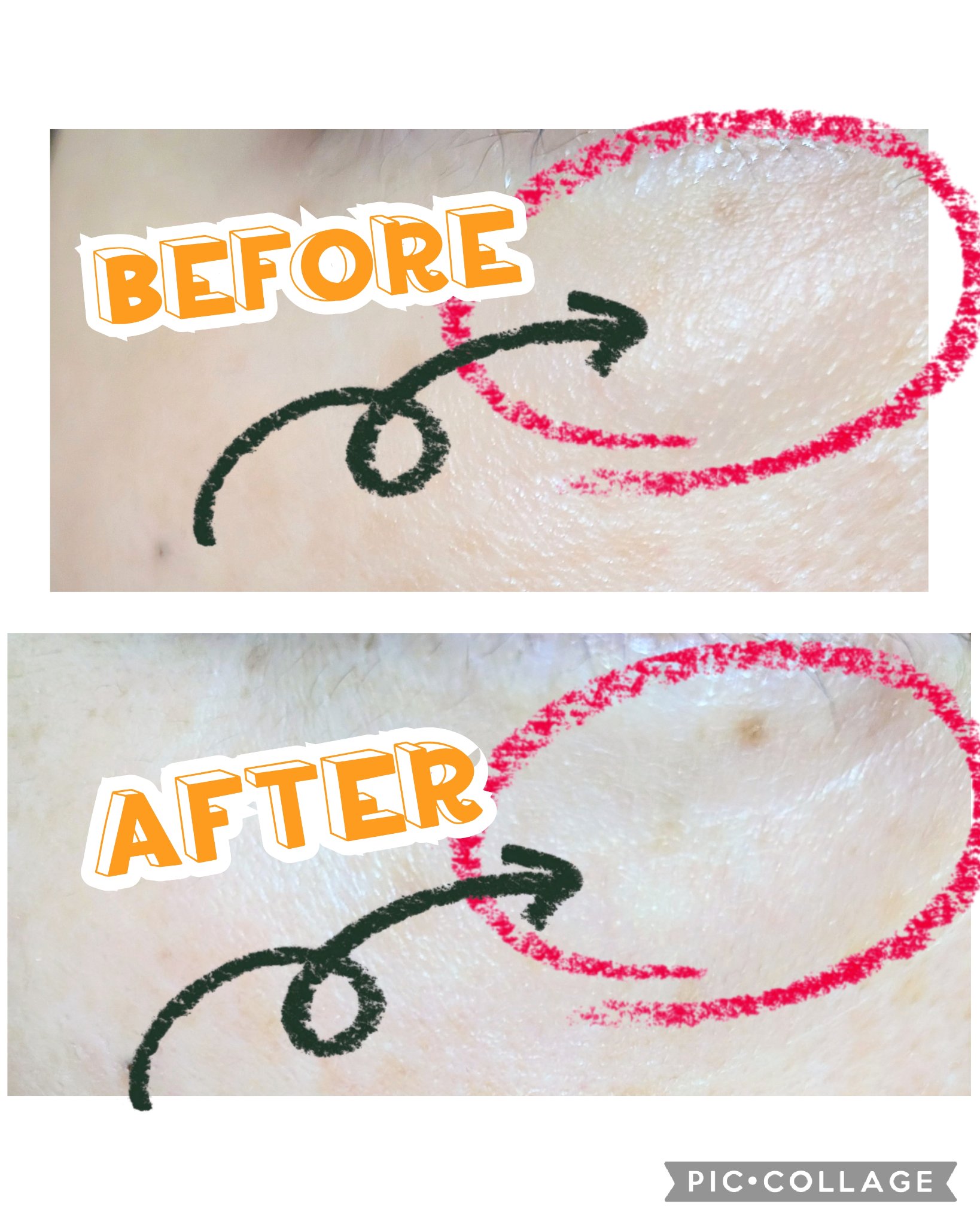 アイバックリフト1100シャットリードルパッチ/CHARDE/シートマスク・パックを使ったクチコミ（2枚目）