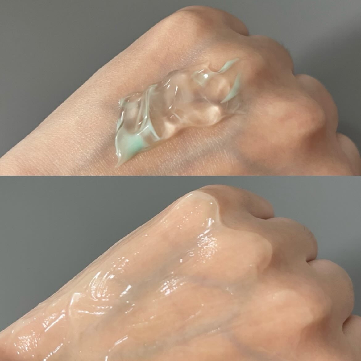 PDRN+リードルS 100/VT/美容液を使ったクチコミ(2枚目)