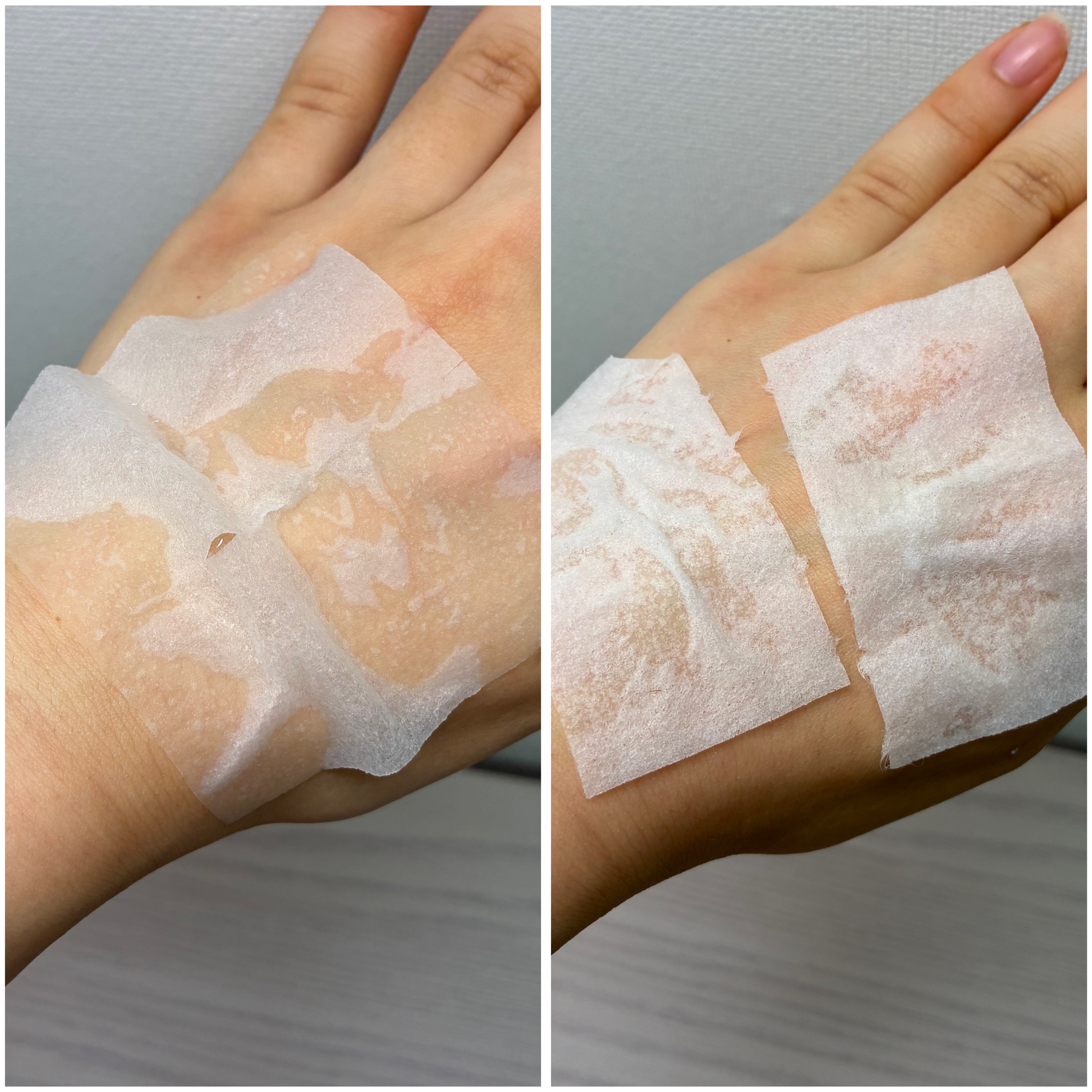 コントロール-Tアシッド クイックブースティングパッド/Real Barrier/トナーパッドを使ったクチコミ（2枚目）