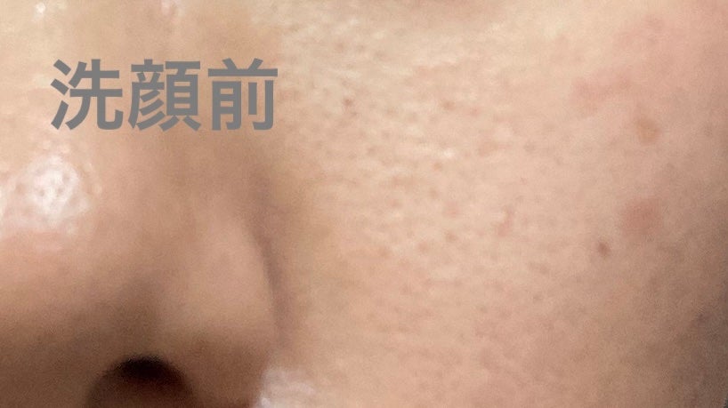 ディープオフオイルN/ティス/オイルクレンジングを使ったクチコミ(1枚目)