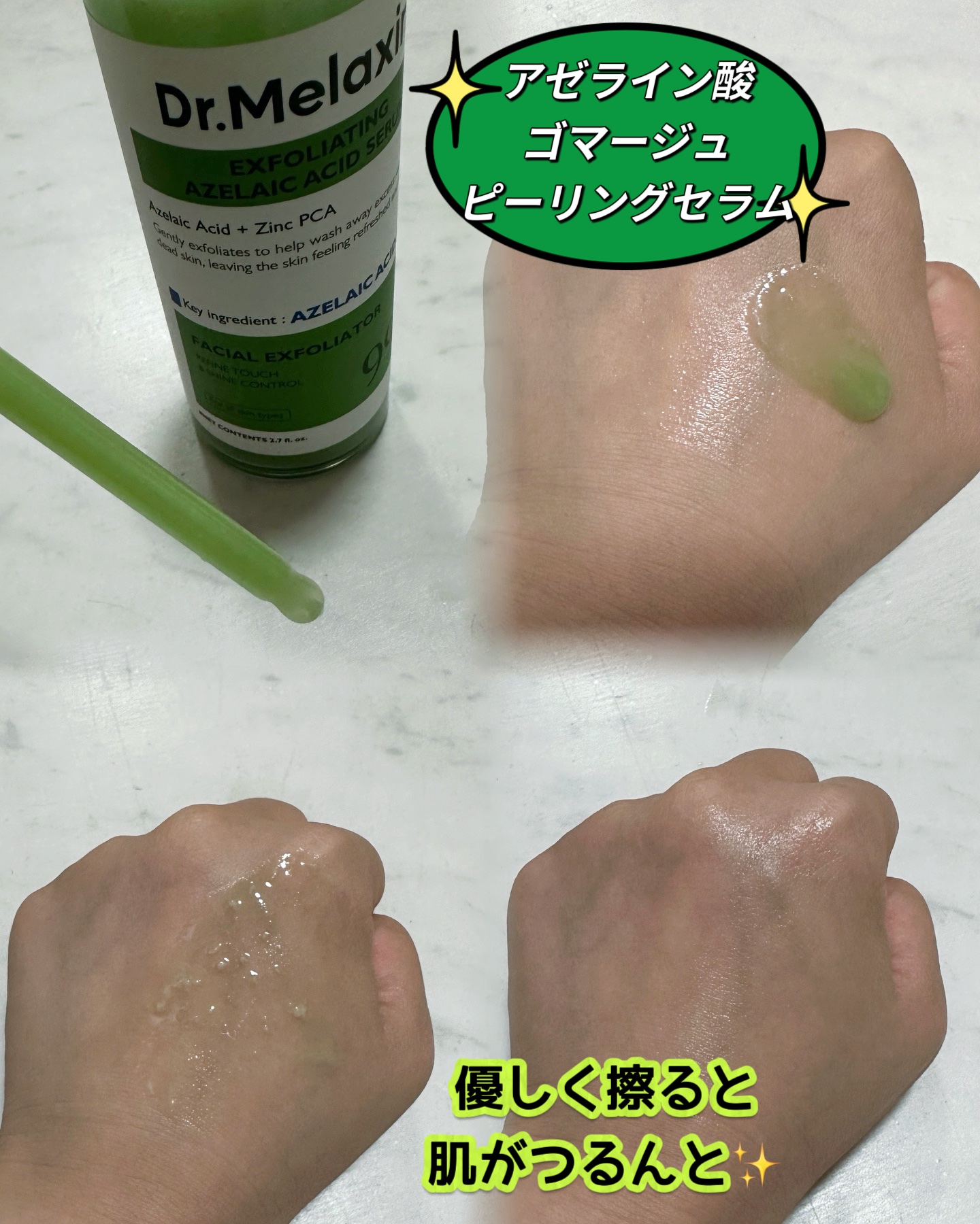アゼライン酸ゴマージュピーリングセラム/Dr.Melaxin/美容液を使ったクチコミ（2枚目）