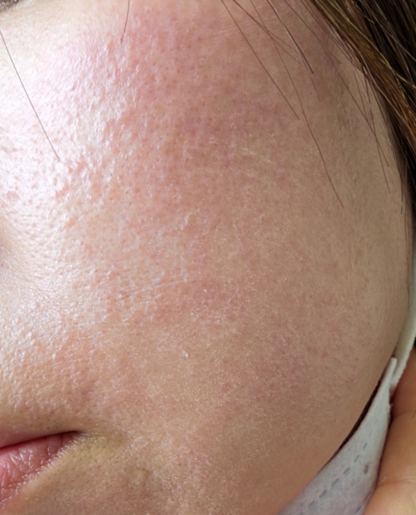 Fru:C ビタミンドロップ/Fru:C/美容液を使ったクチコミ（1枚目）