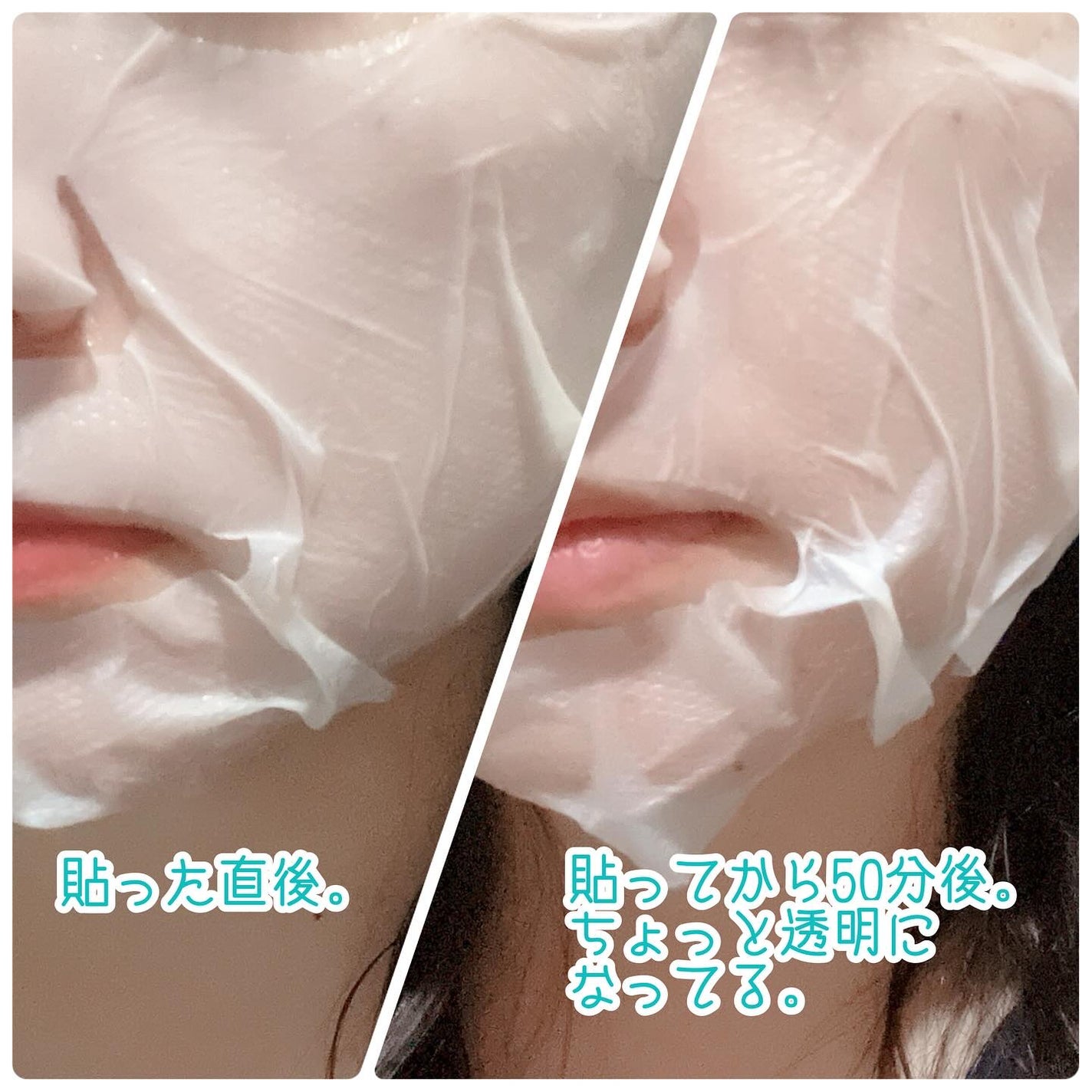 サミュ ガラクトポア ディープクリーン 2ステップマスク/SAM'U/シートマスク・パックを使ったクチコミ(4枚目)