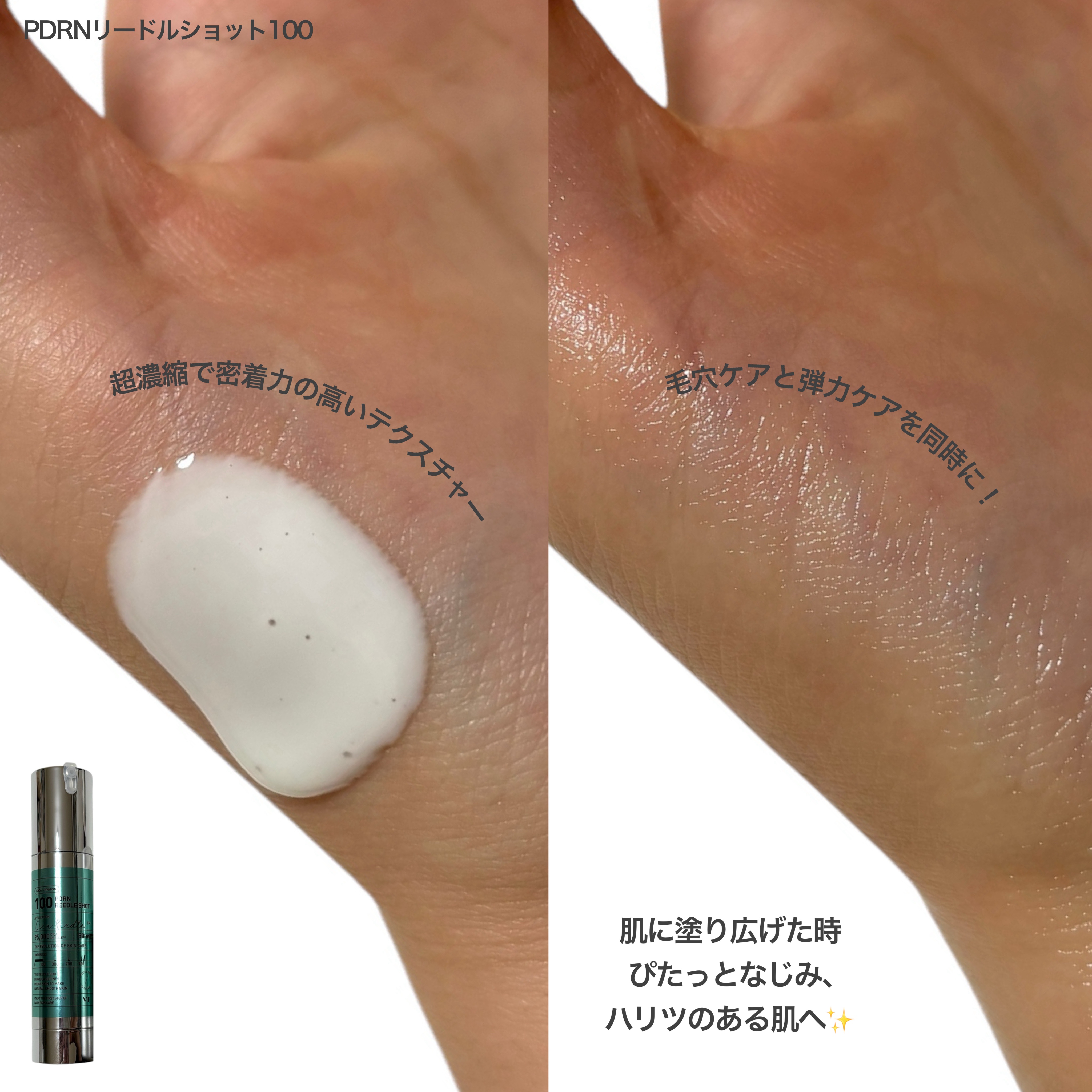 PDRN ヒアルロン酸 ミントマイクロバブルセラム/VT/美容液を使ったクチコミ（2枚目）