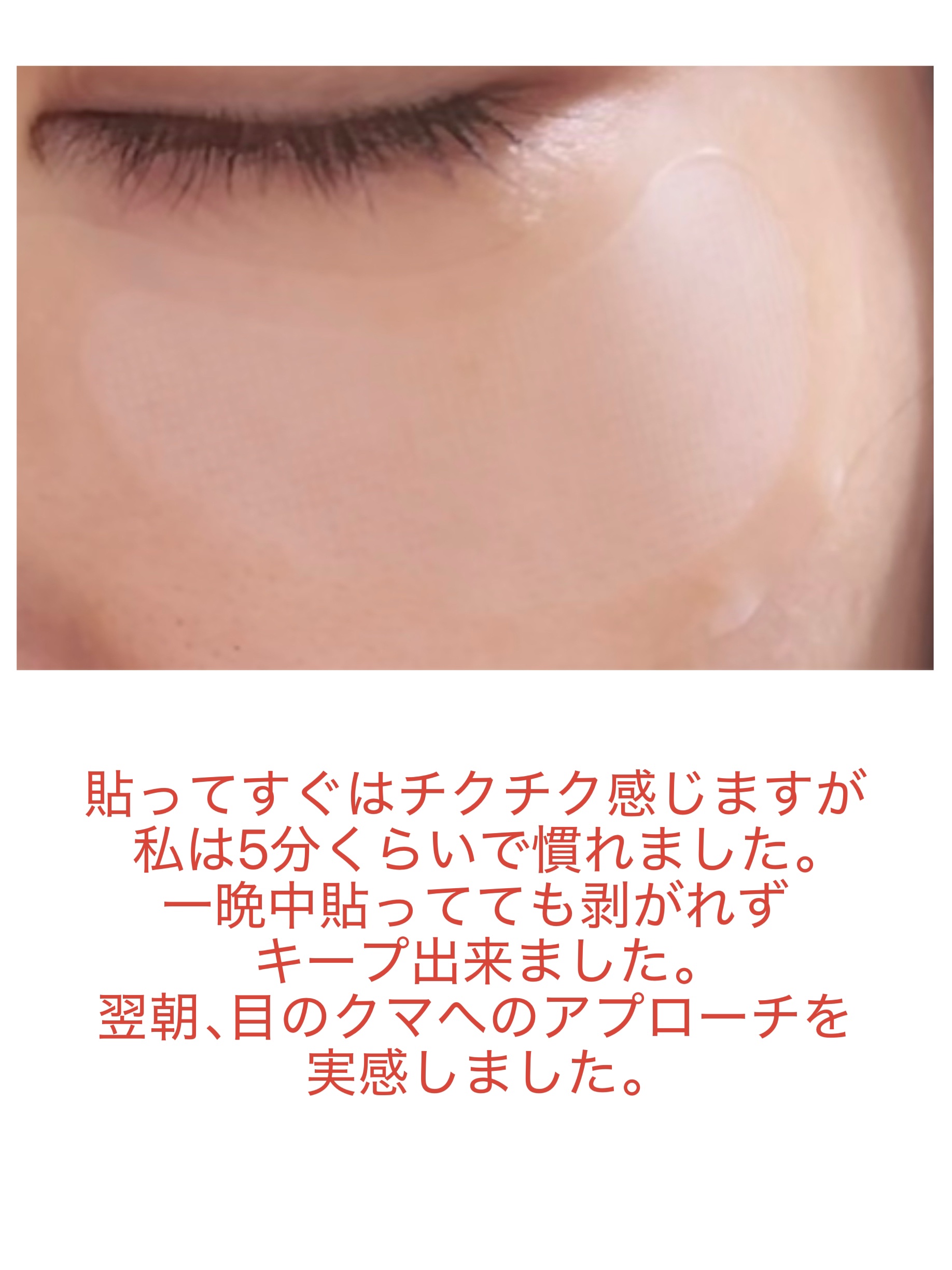 アイバックリフト1100シャットリードルパッチ/CHARDE/シートマスク・パックを使ったクチコミ（3枚目）