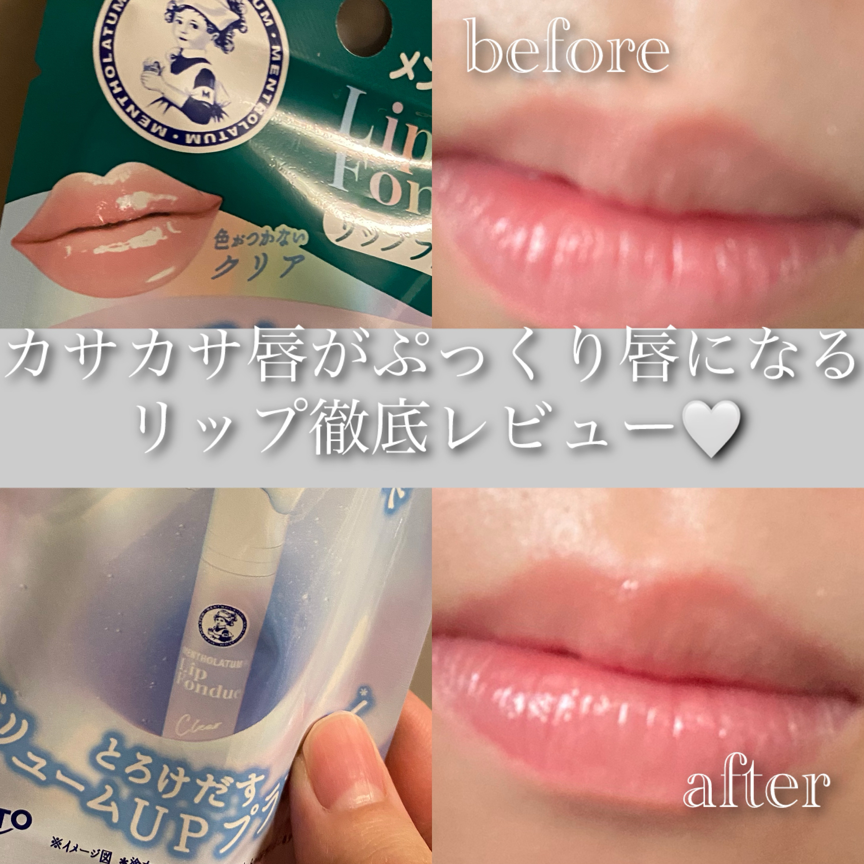 メンソレータム リップフォンデュ/メンソレータム/リッププランパーを使ったクチコミ（1枚目）