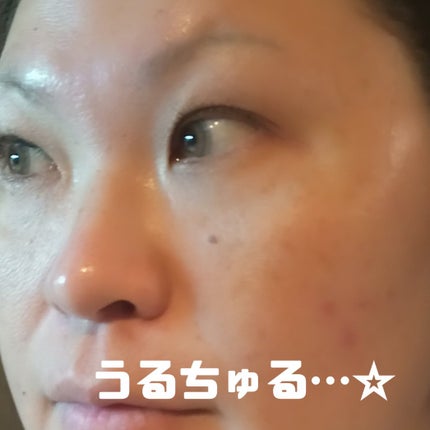 ヒアルロン酸モイスチャー ブラックマスク/我的心機/シートマスク・パックを使ったクチコミ(6枚目)