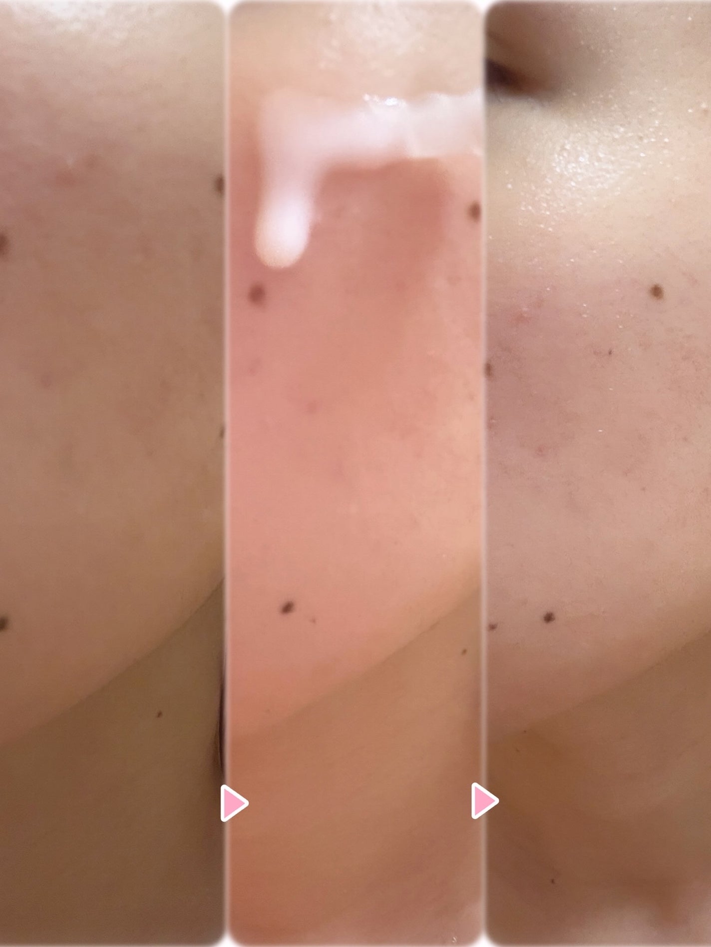 トーン&スポットコレクターアンプル/redence/美容液を使ったクチコミ(4枚目)