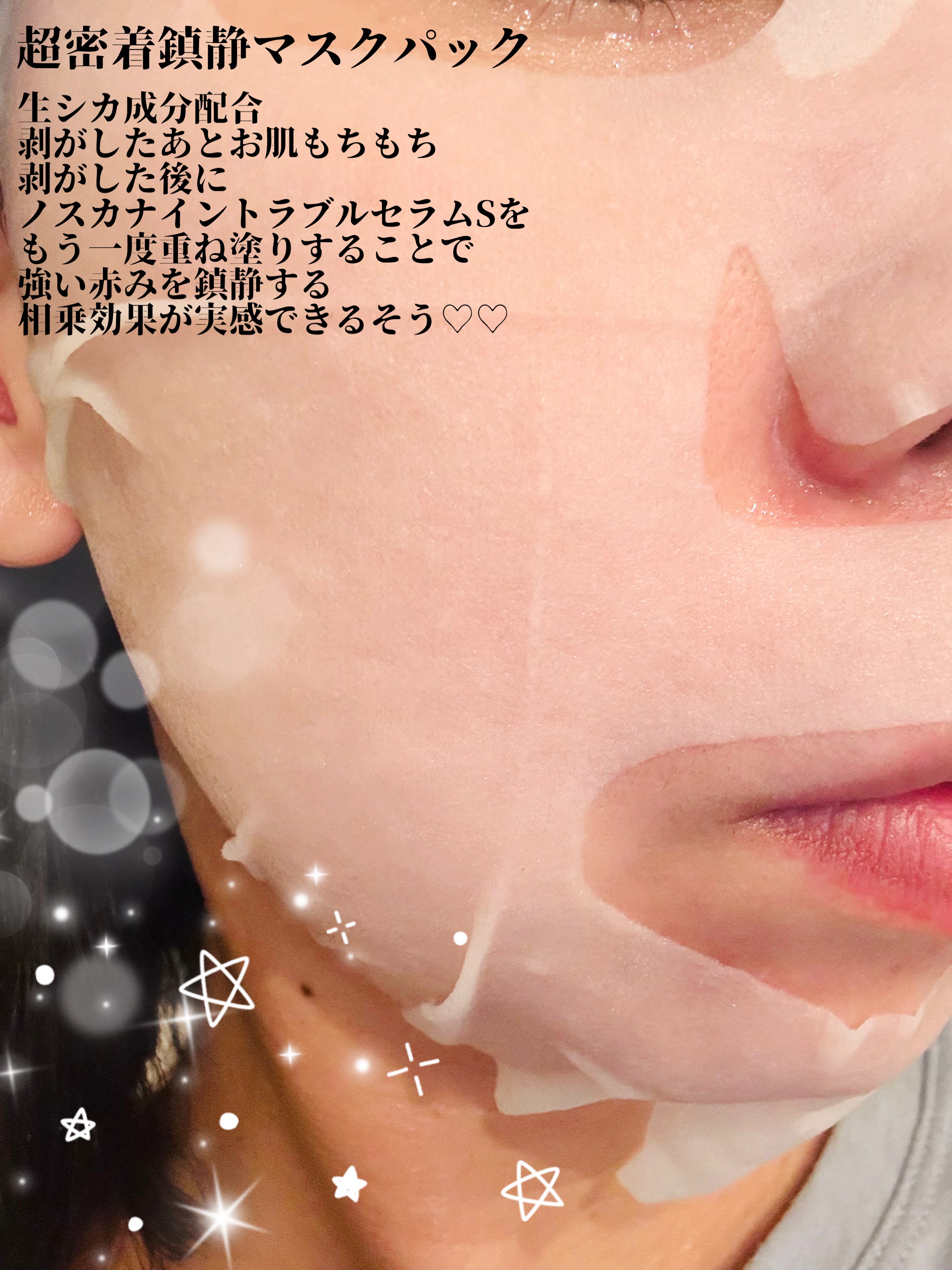 ノスカナイン T セラムマスク S/FATION/シートマスク・パックを使ったクチコミ（2枚目）