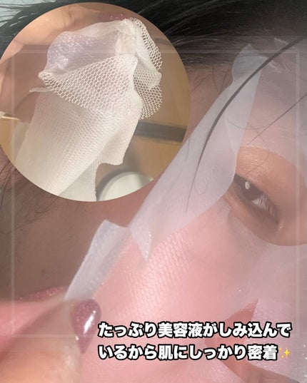 トラブルパッチマスク/EIOM/その他スキンケアを使ったクチコミ(3枚目)