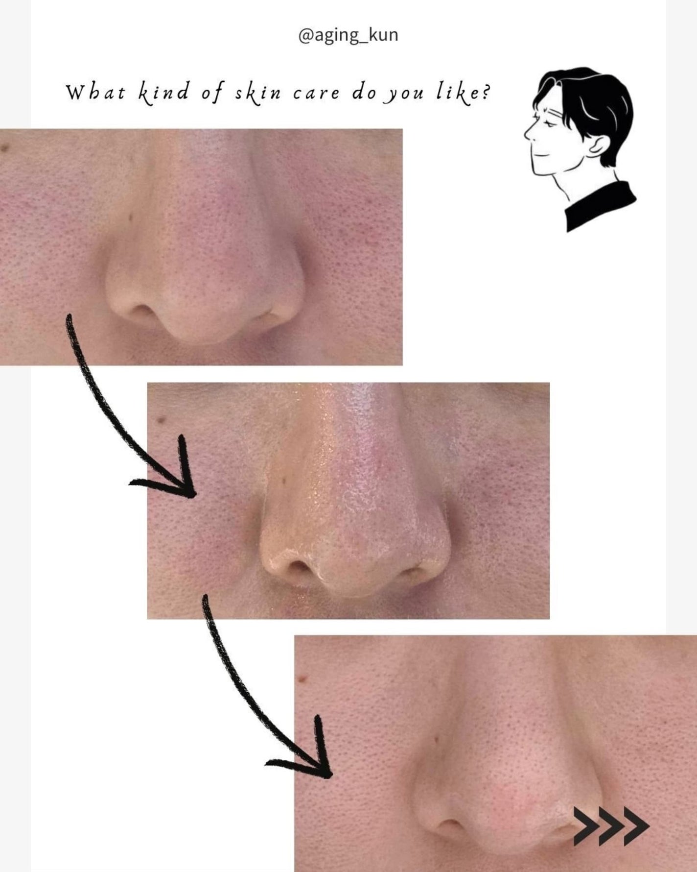 ティーツリージェルクレンジングオイル/KindStep/クレンジングジェルを使ったクチコミ(4枚目)