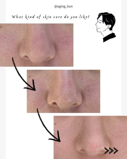 ティーツリージェルクレンジングオイル/KindStep/クレンジングジェルを使ったクチコミ(4枚目)