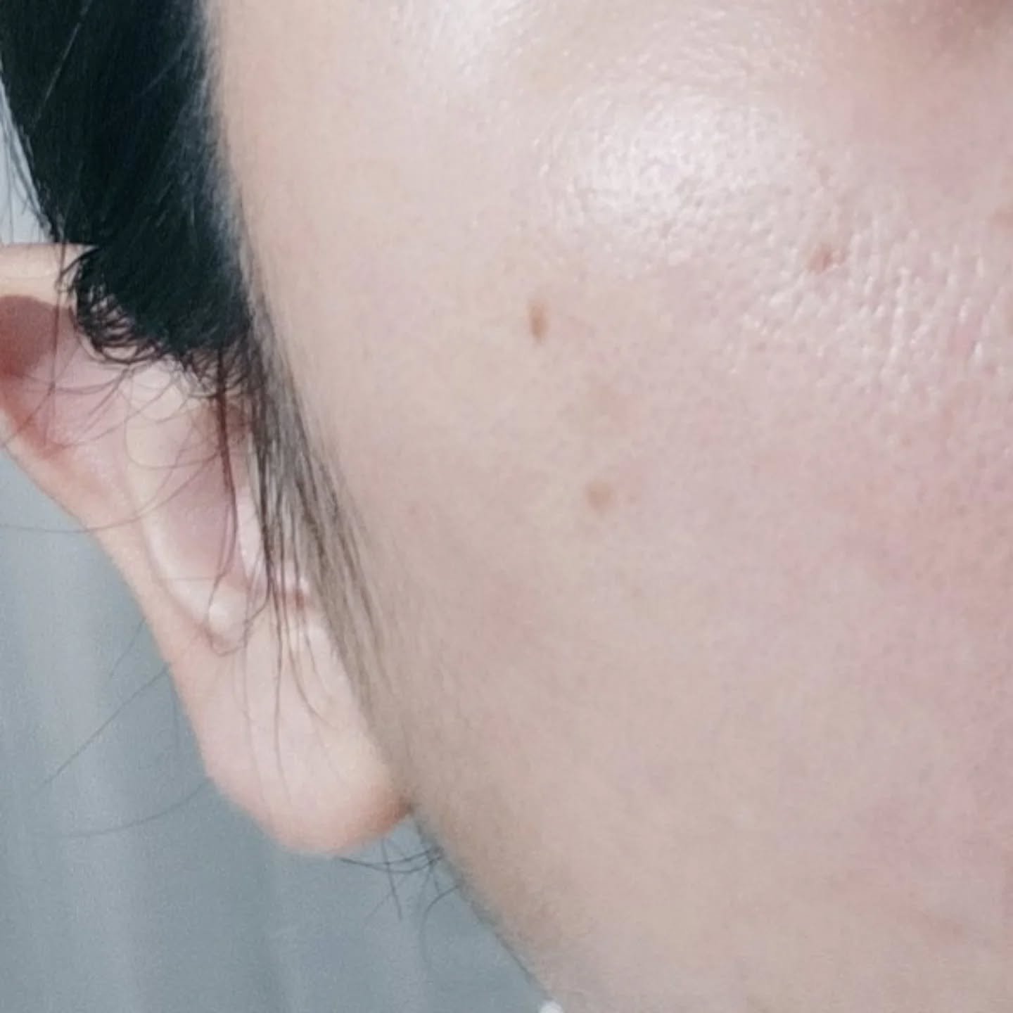 ヨエスターGLTダイレクトウルトラX/ESTHER FORMULA/美容サプリメントを使ったクチコミ（3枚目）