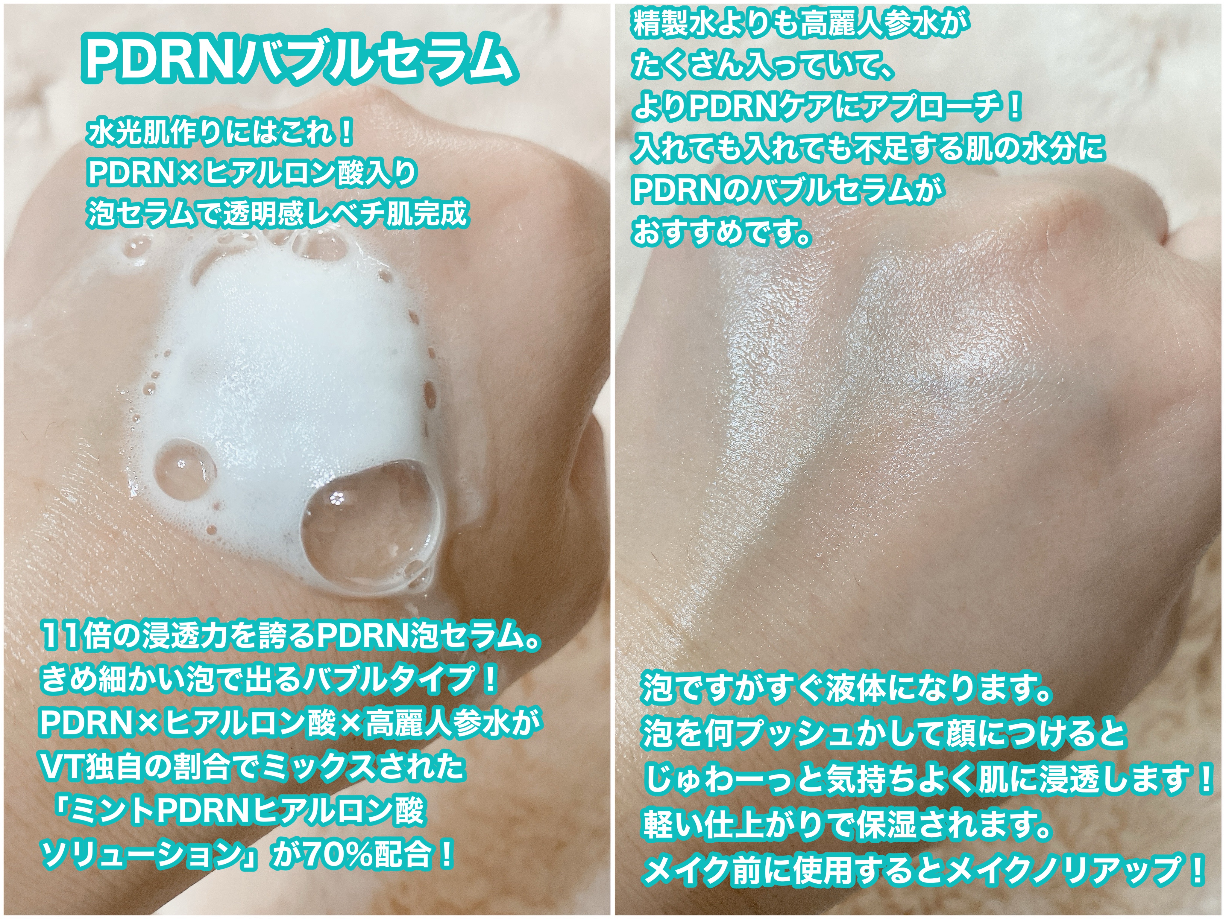 PDRN ヒアルロン酸 ミントマイクロバブルセラム/VT/美容液を使ったクチコミ（3枚目）