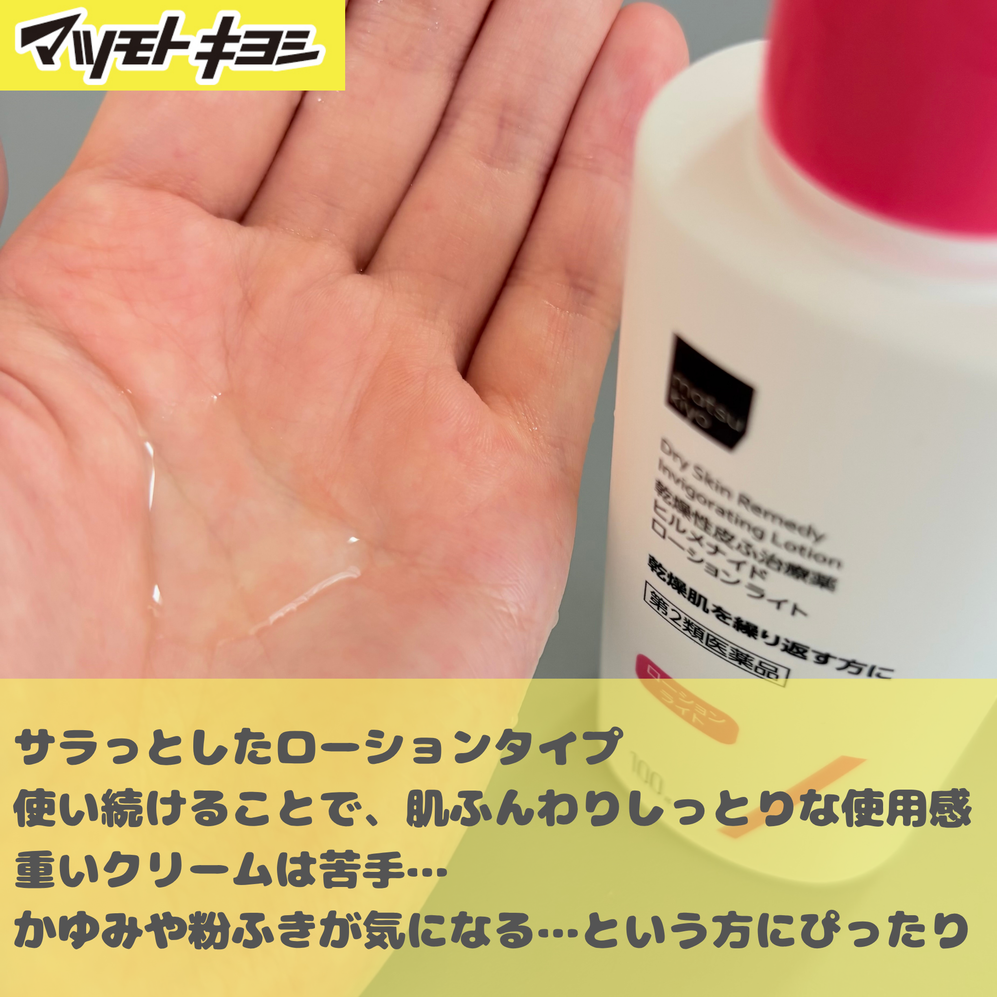 ヒルメナイドローション(医薬品)/matsukiyo/その他を使ったクチコミ（2枚目）