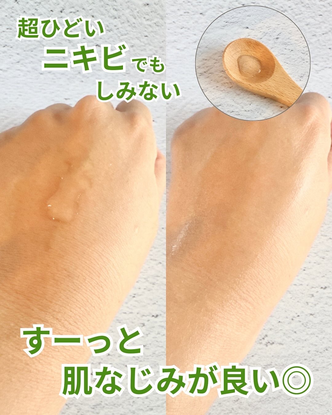 ノスカナイン T セラムマスク S/FATION/シートマスク・パックを使ったクチコミ(4枚目)