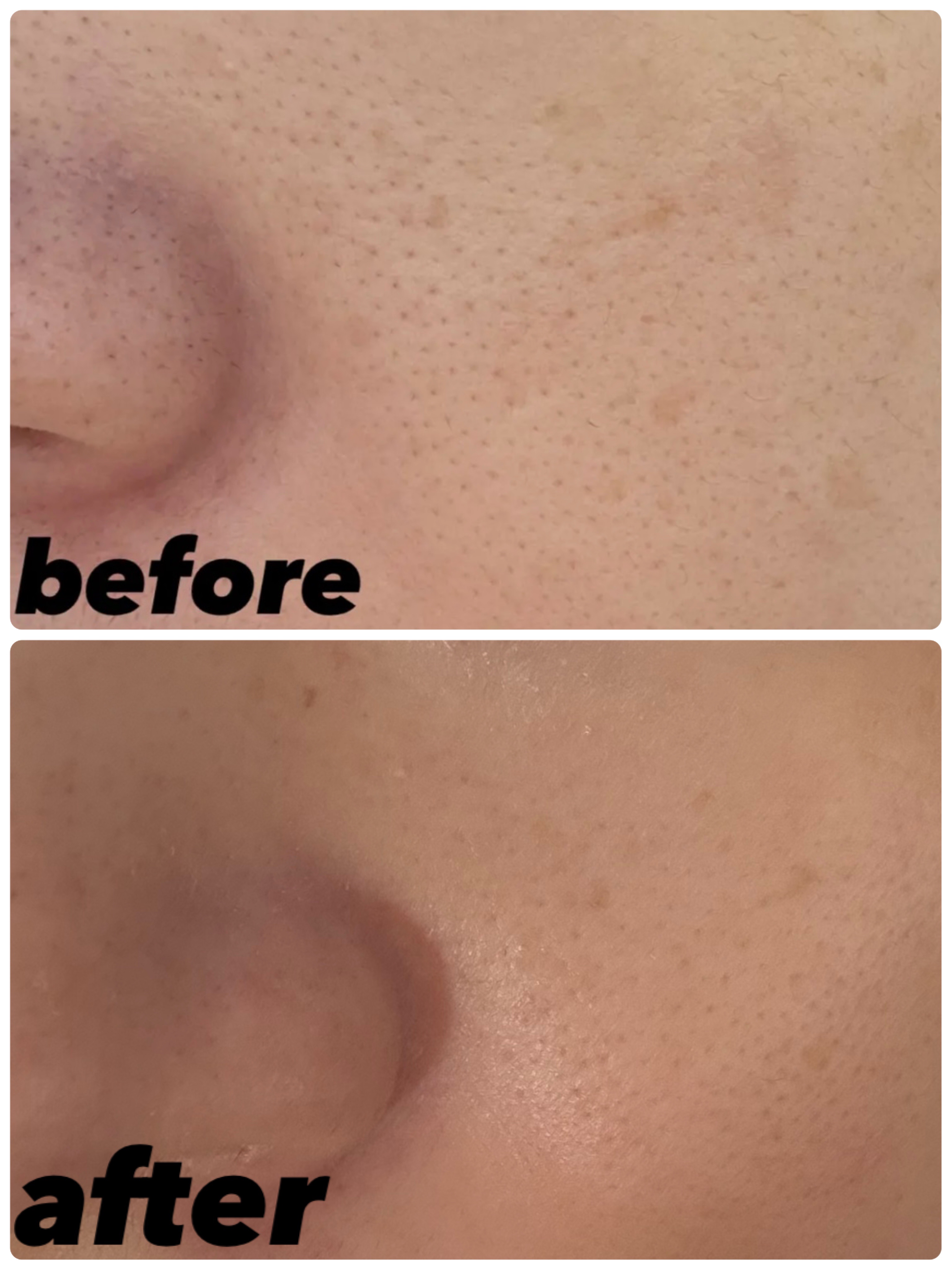 オールアバウトグロウカバークリーム/CHASIN'RABBITS/日焼け止めクリームを使ったクチコミ（2枚目）