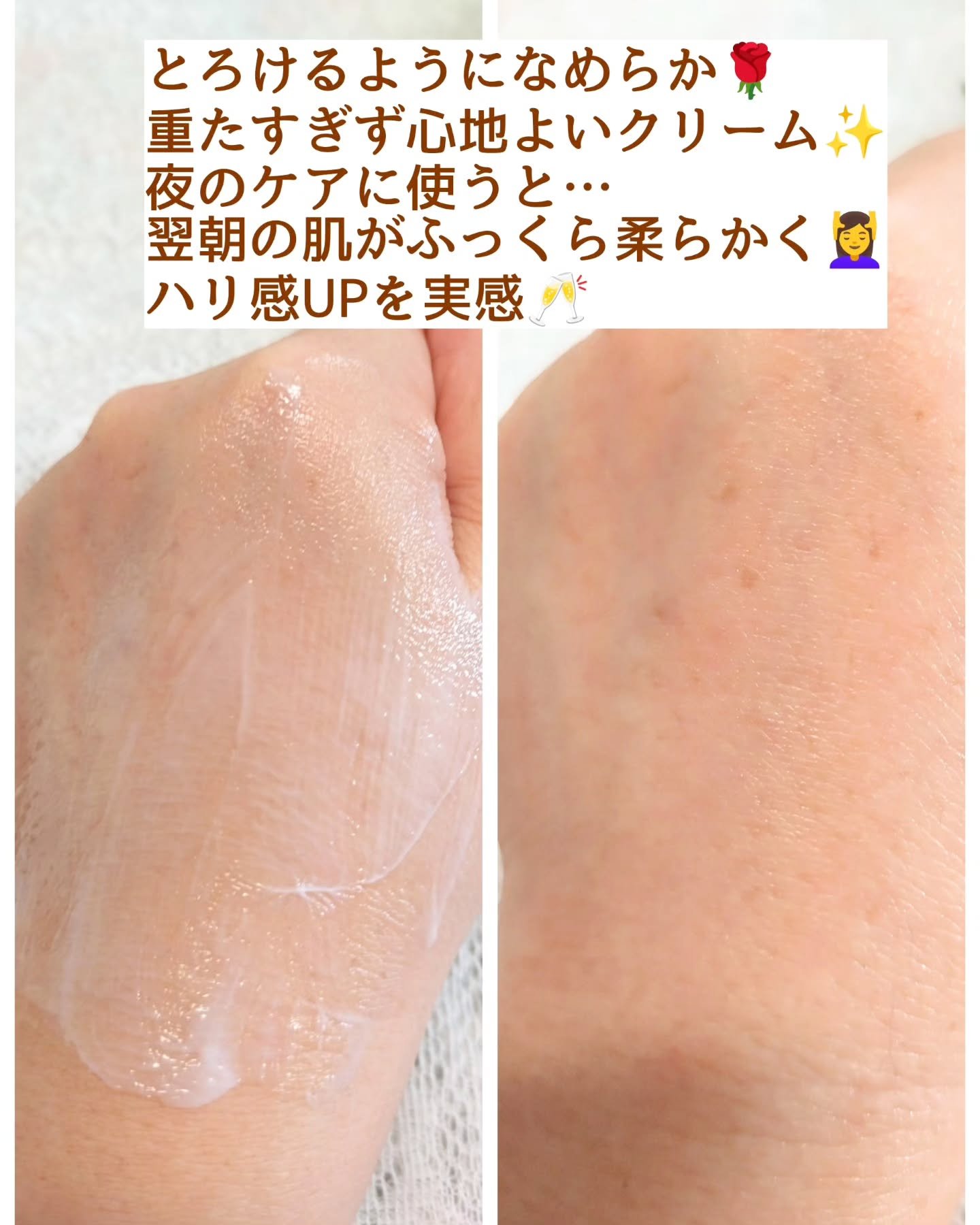 スーパーQuSomeクリーム/b.glen/フェイスクリームを使ったクチコミ（3枚目）