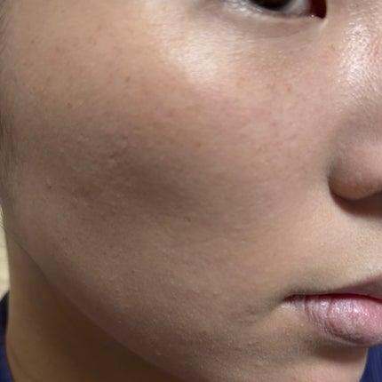 愛されファンデ/b idol/リキッドファンデーションを使ったクチコミ(5枚目)