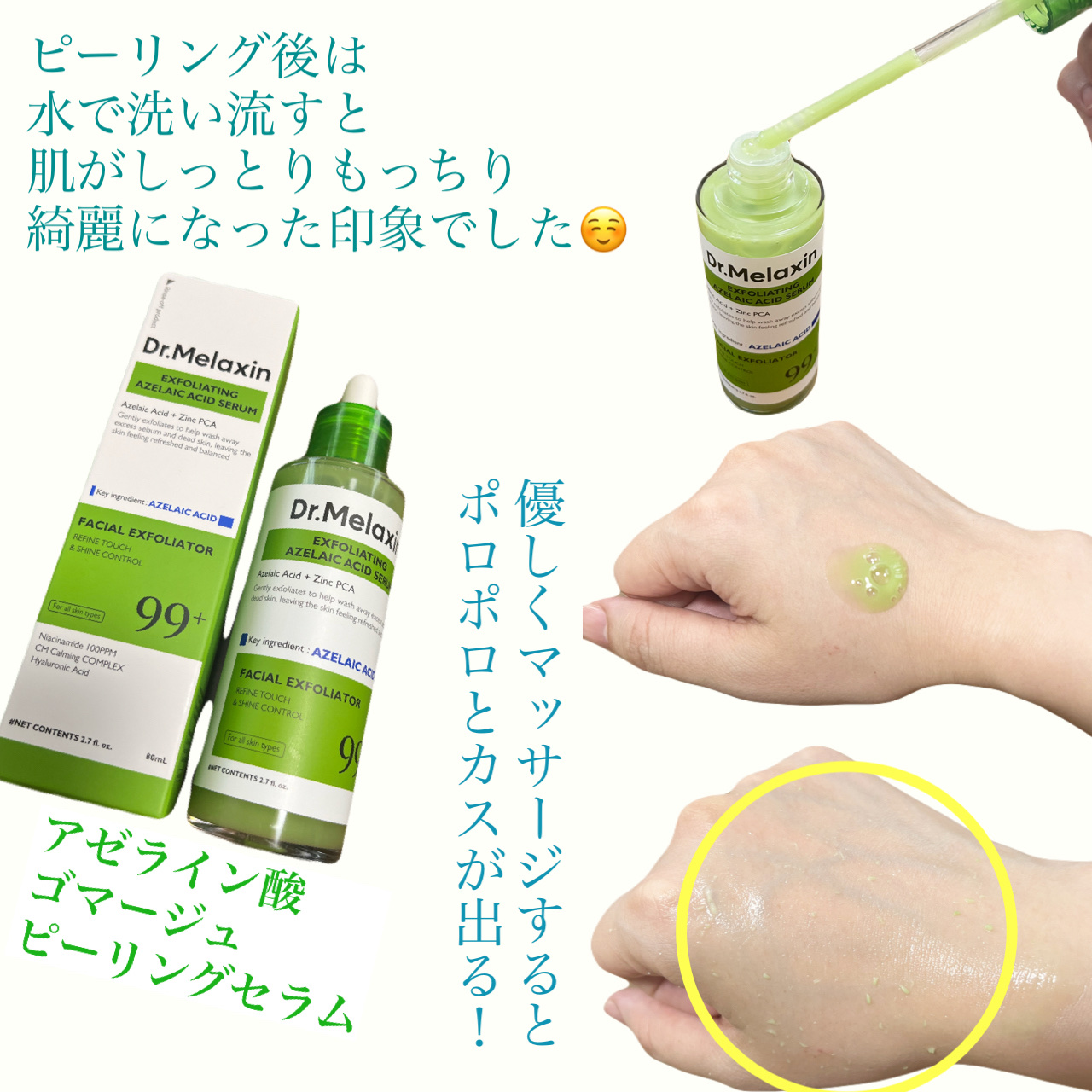 アゼライン酸ゴマージュピーリングセラム/Dr.Melaxin/美容液を使ったクチコミ（2枚目）