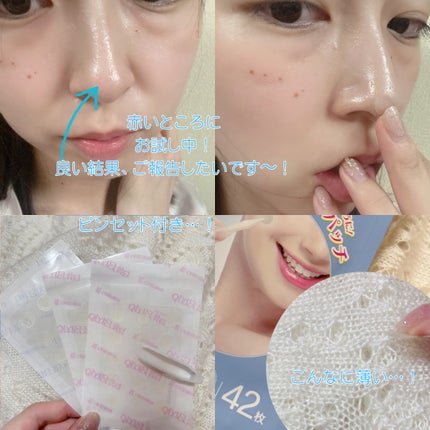 ビューティー スポットパッチ/イージーダムビューティー/にきびパッチを使ったクチコミ(2枚目)