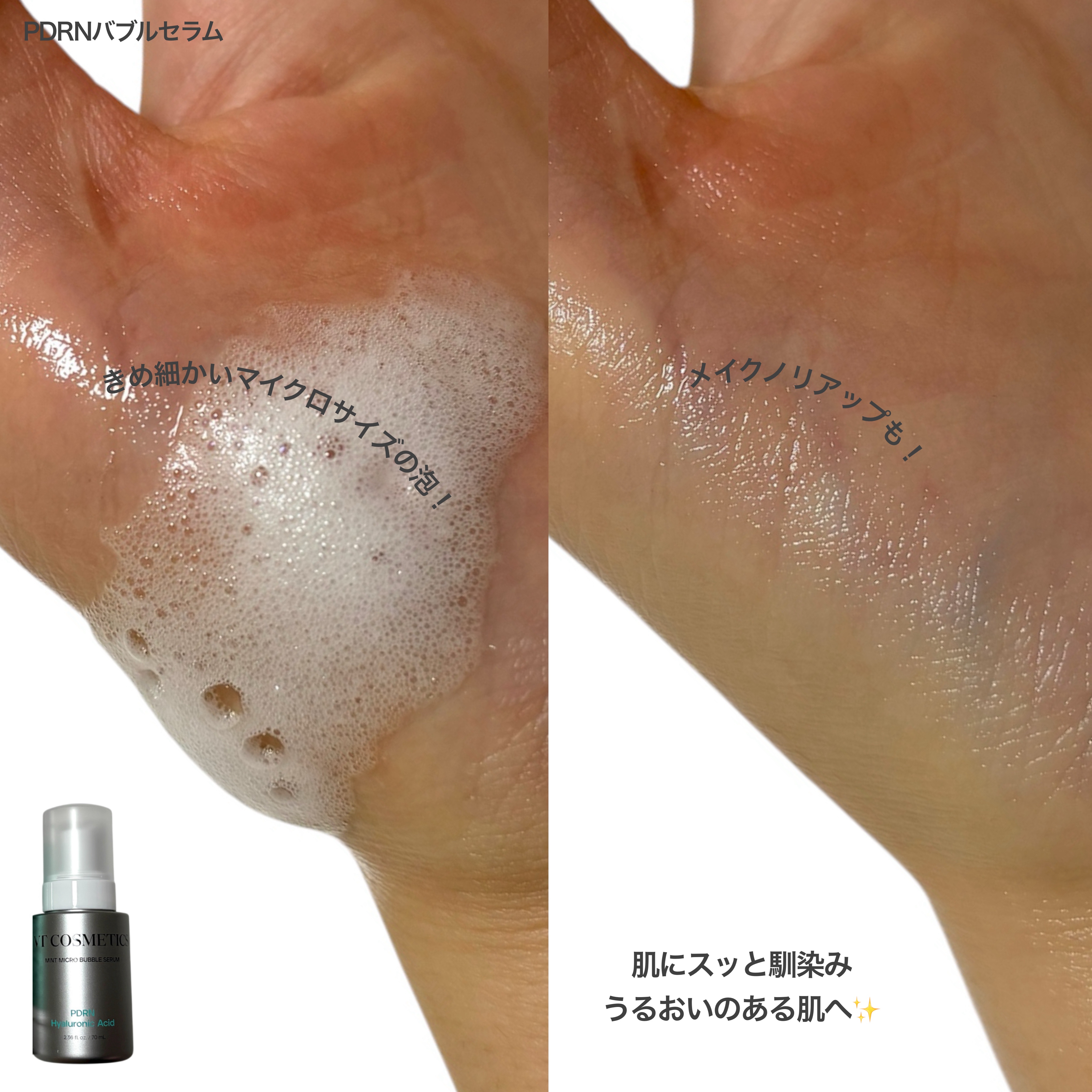 PDRN ヒアルロン酸 ミントマイクロバブルセラム/VT/美容液を使ったクチコミ（3枚目）