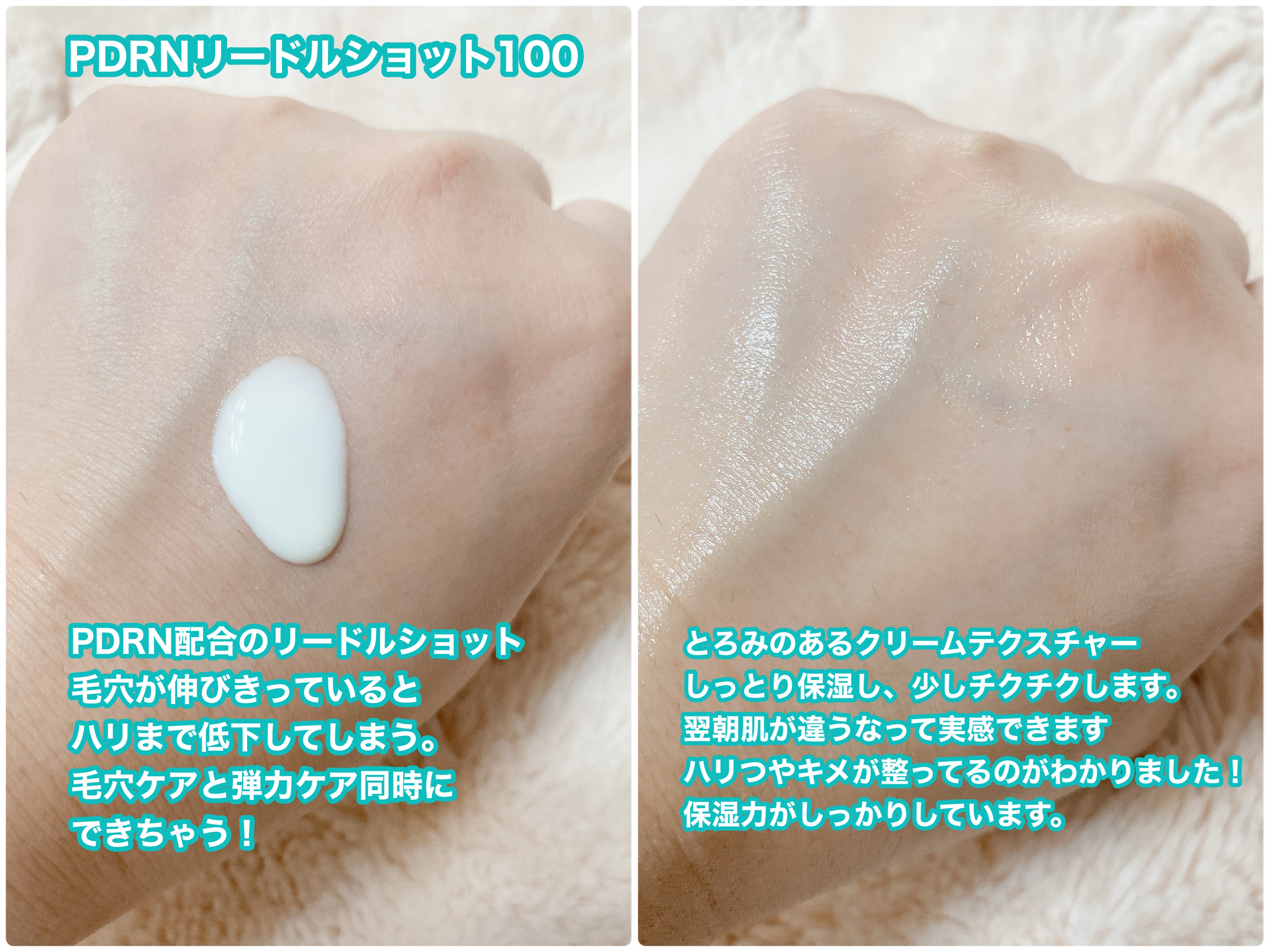 PDRN ヒアルロン酸 ミントマイクロバブルセラム/VT/美容液を使ったクチコミ（2枚目）