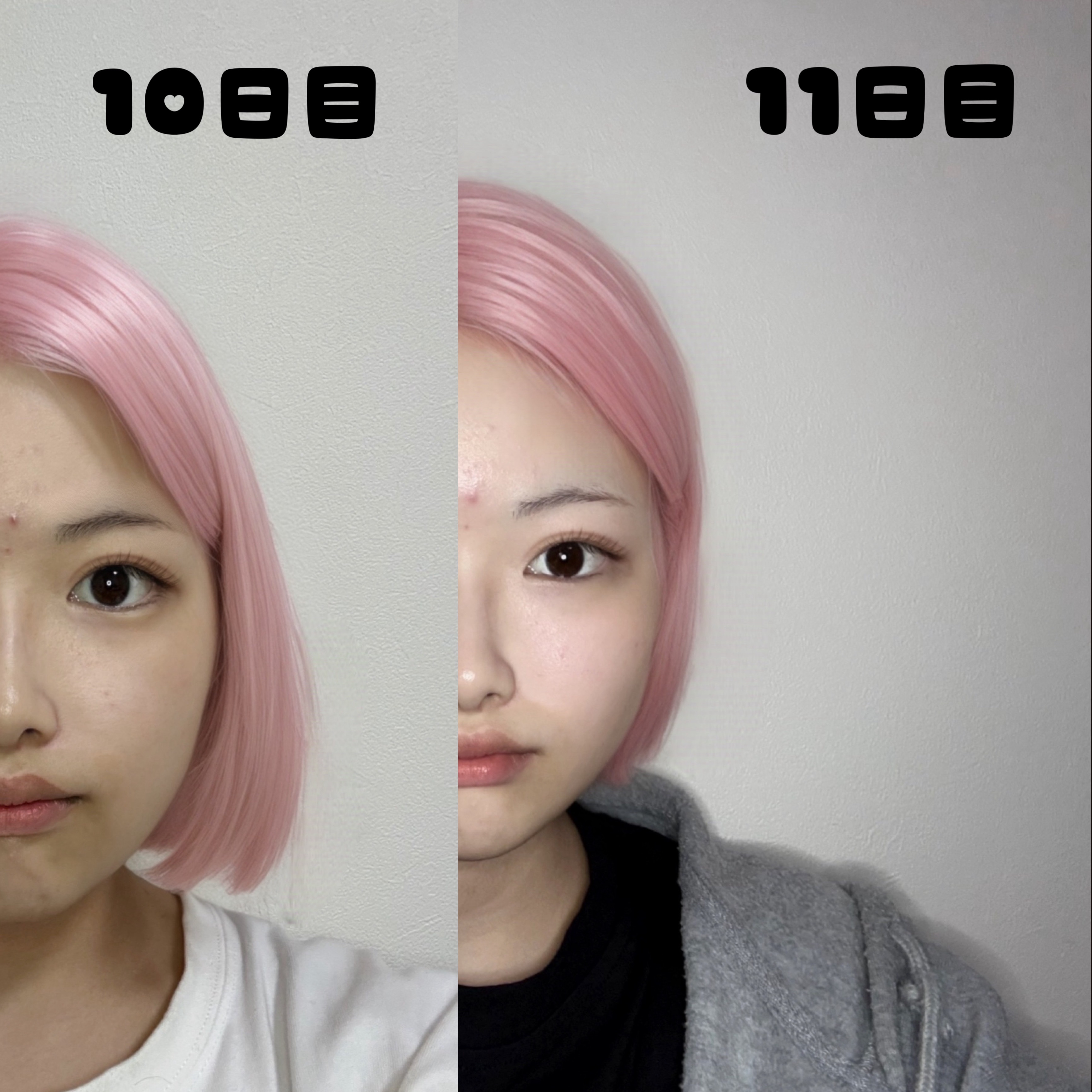 薬用しみ対策 美白化粧水/メラノCC/化粧水を使ったクチコミ（2枚目）