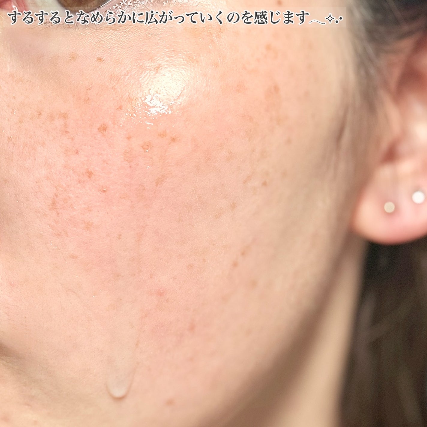 クラウドアンプル 1week キット/CHARDE/美容液を使ったクチコミ(6枚目)