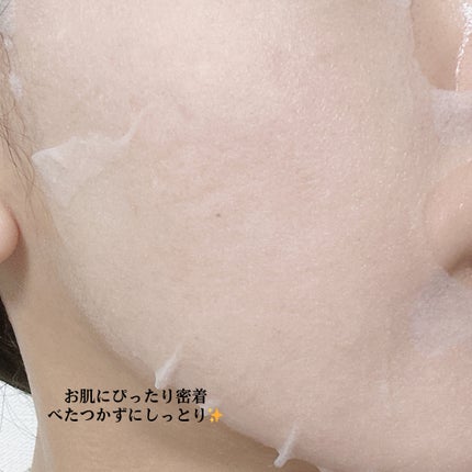 マデカソサイド ブレミッシュパッド/MEDIHEAL/トナーパッドを使ったクチコミ(3枚目)