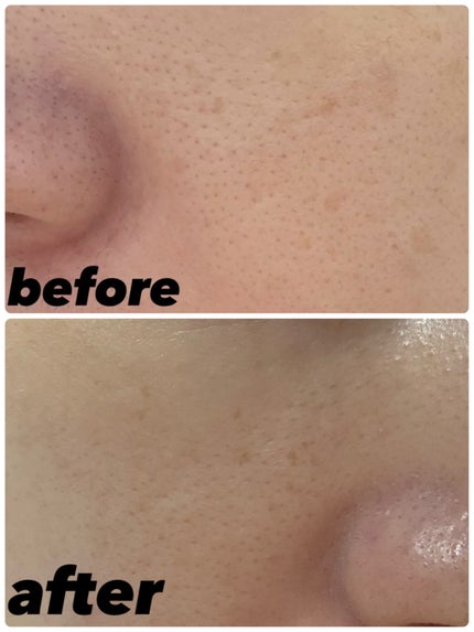 オールアバウトグロウトーンアップクリーム/CHASIN'RABBITS/化粧下地を使ったクチコミ(3枚目)