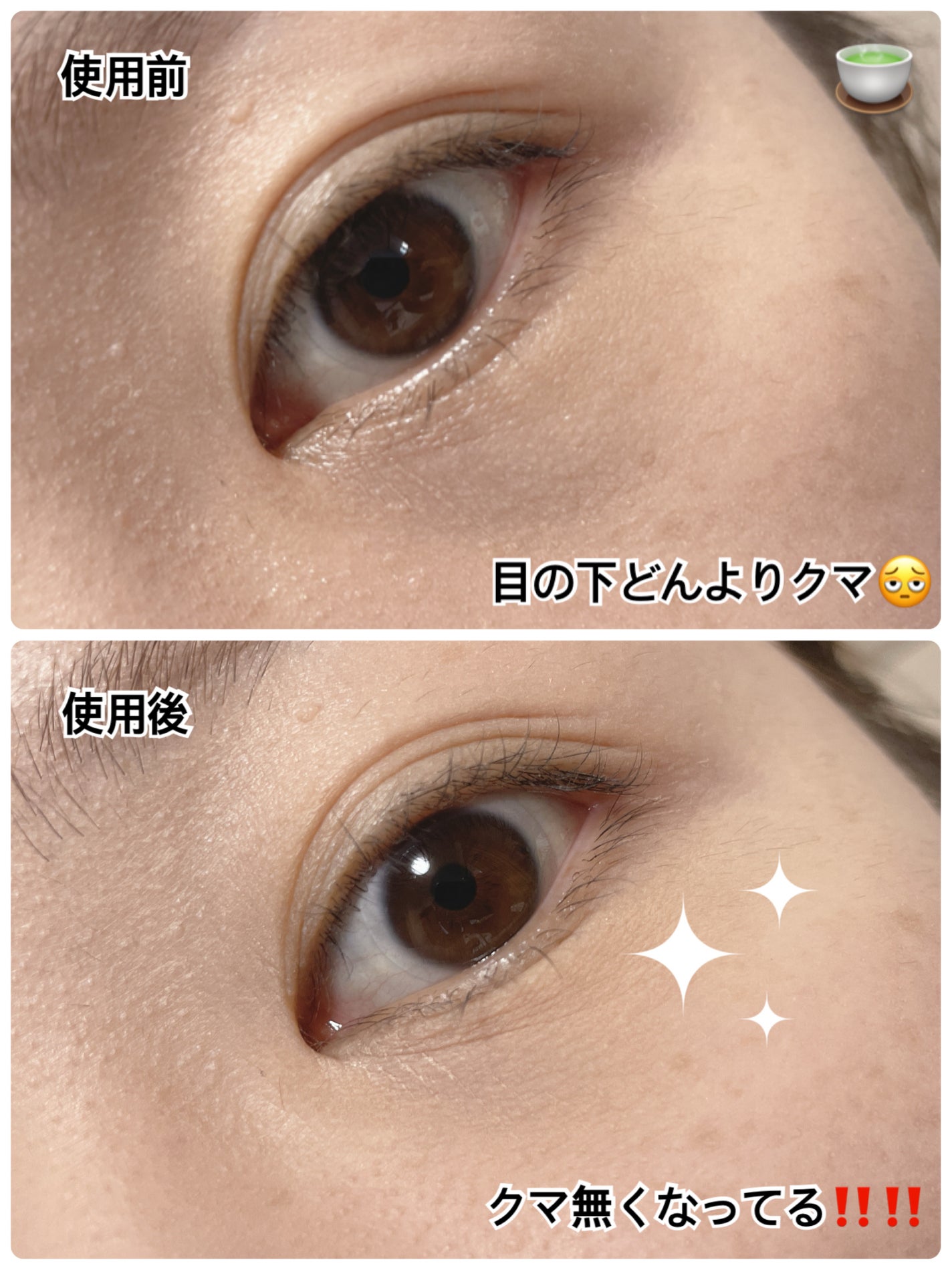 カバーアッププロコンシーラー/TFIT/パレットコンシーラーを使ったクチコミ(2枚目)