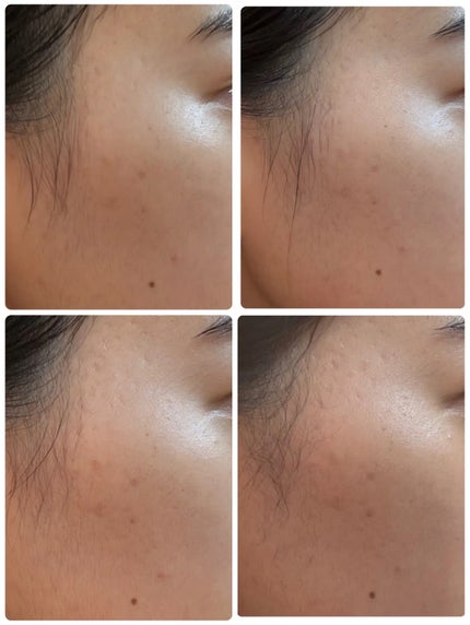 PDRN ヒアルロン酸 ミントマイクロバブルセラム/VT/美容液を使ったクチコミ(3枚目)